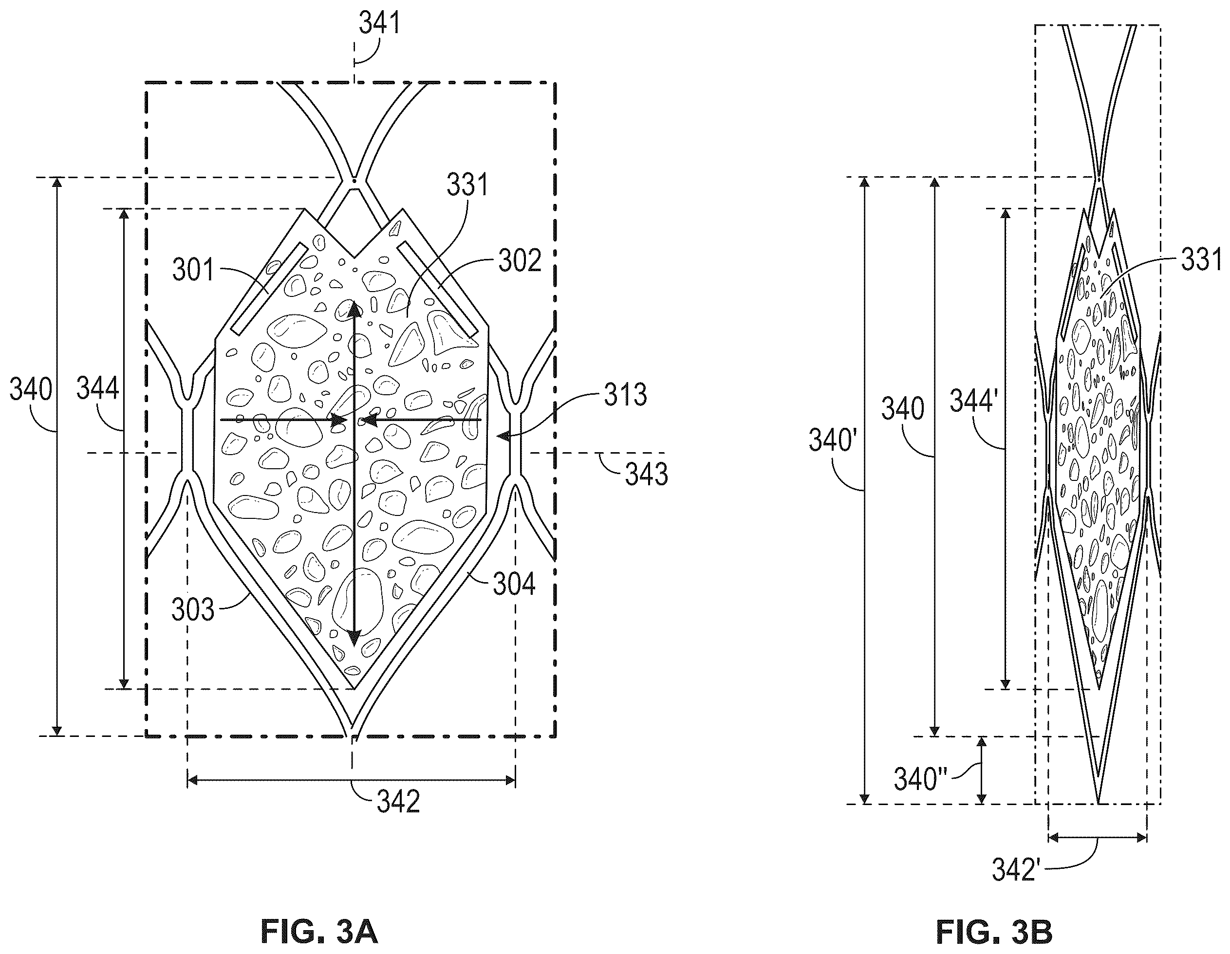 Patent US12508127 Figure 3 – Shape memory polymer foams to seal space around valves