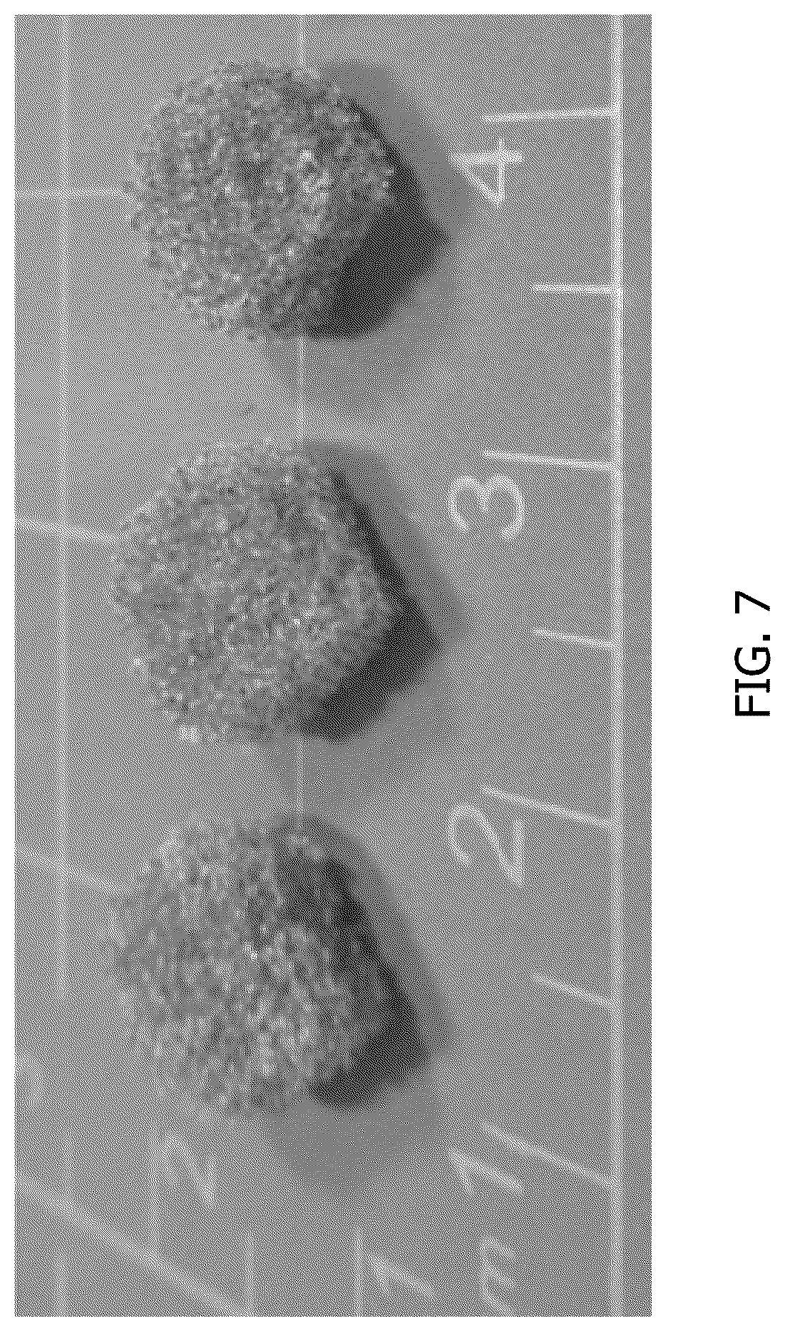 Patent US12508127 Figure 7 – Shape memory polymer foams to seal space around valves