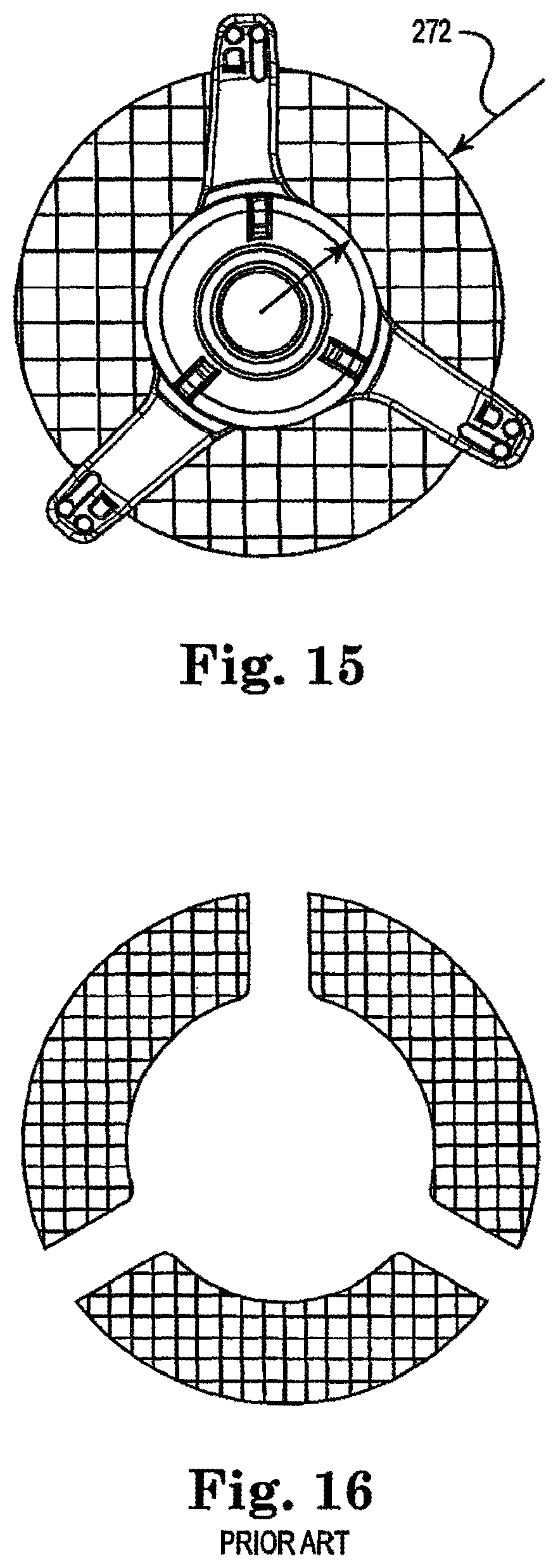 Patent US12508128 Figure 11 – Valve delivery device