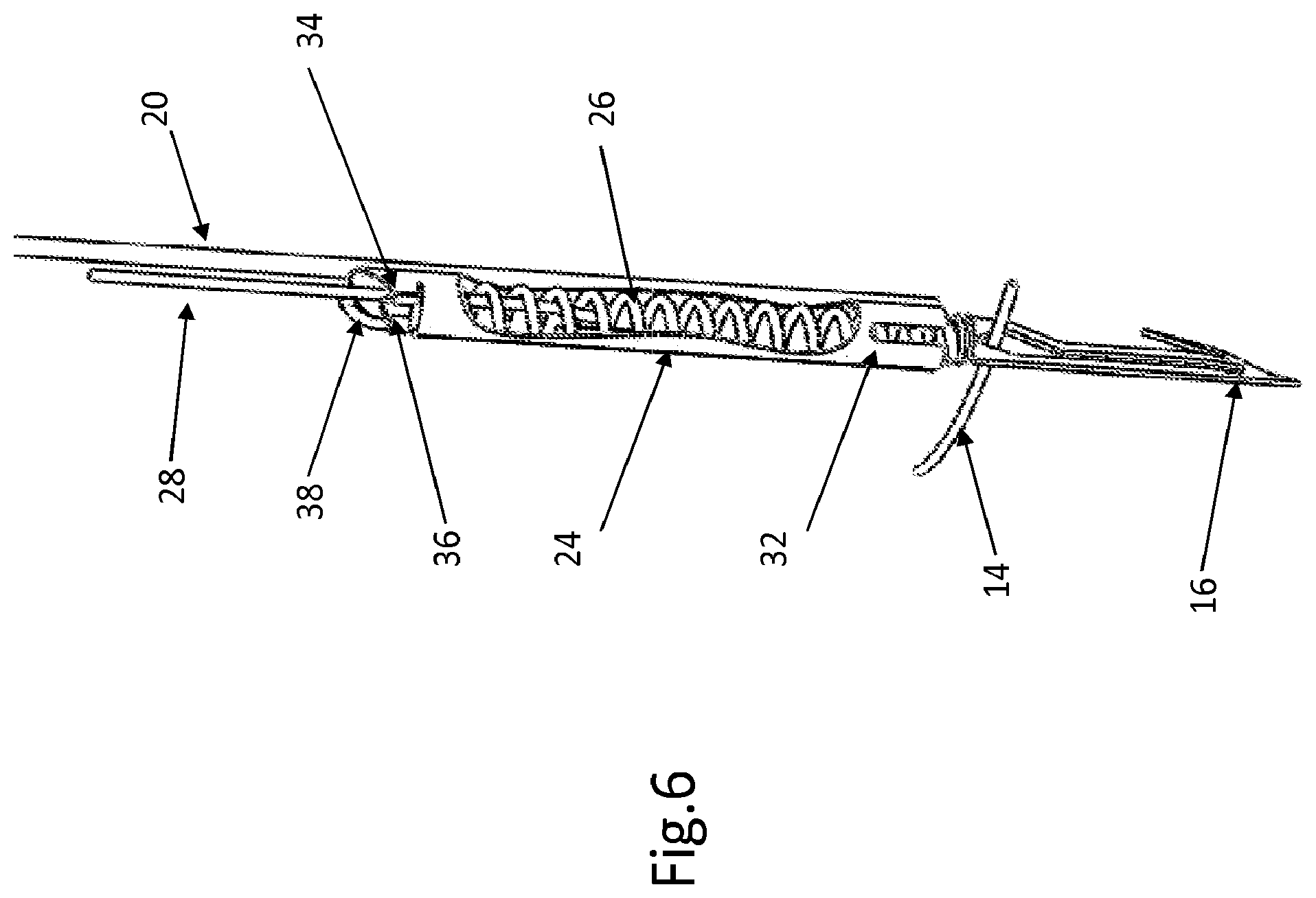 Patent US12508129 Figure 4 – Cardiac valve replacement