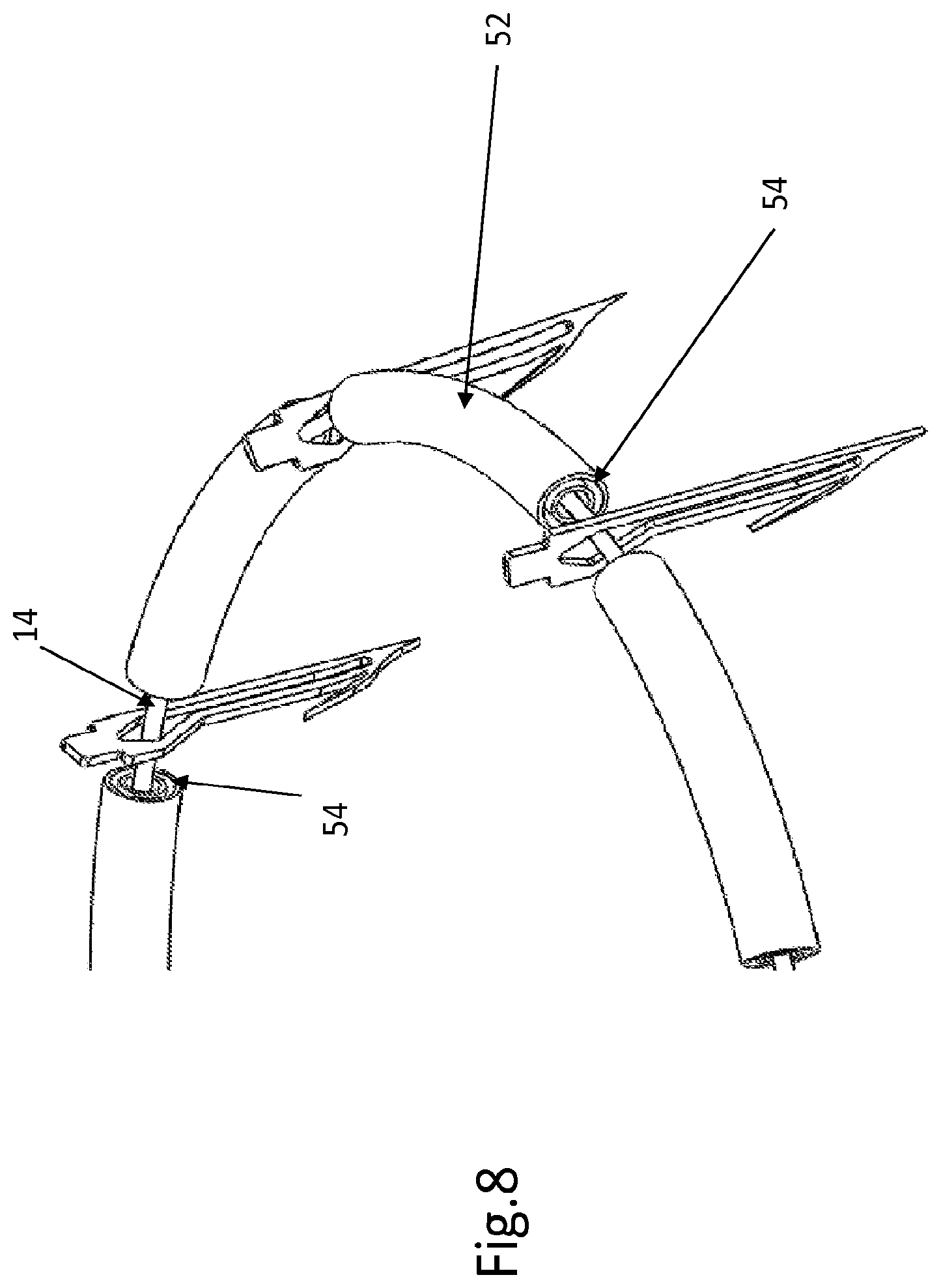 Patent US12508129 Figure 6 – Cardiac valve replacement