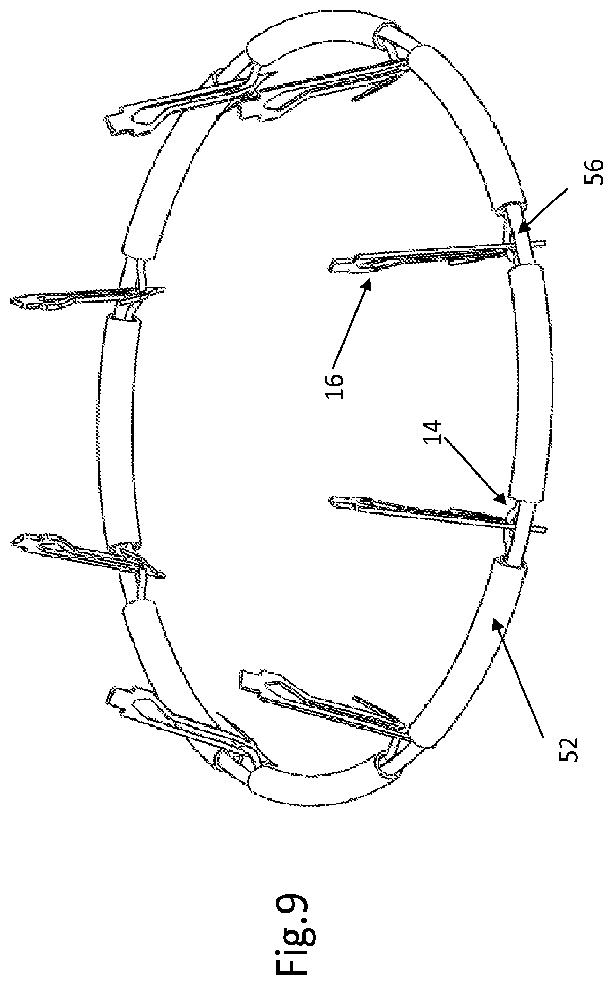 Patent US12508129 Figure 7 – Cardiac valve replacement
