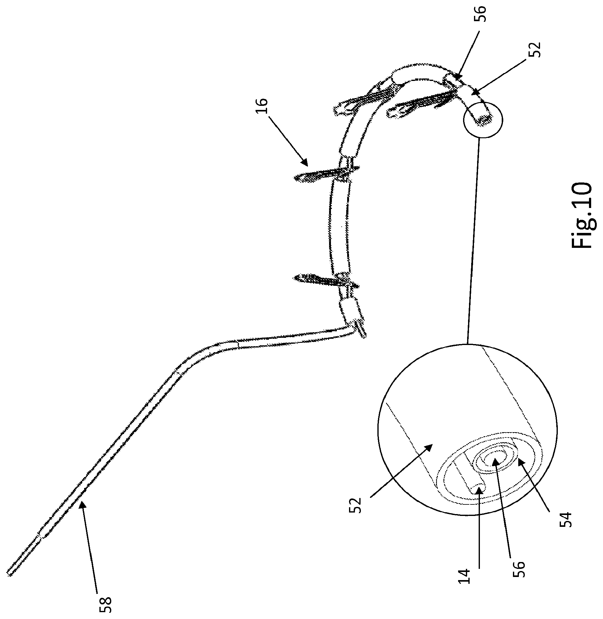 Patent US12508129 Figure 8 – Cardiac valve replacement