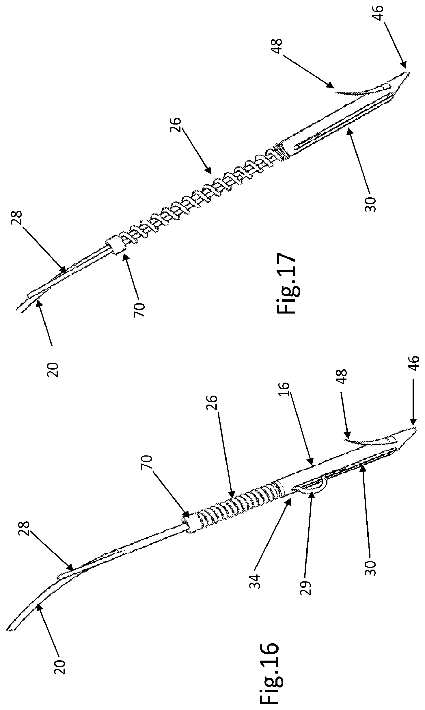 Patent US12508129 Figure 13 – Cardiac valve replacement