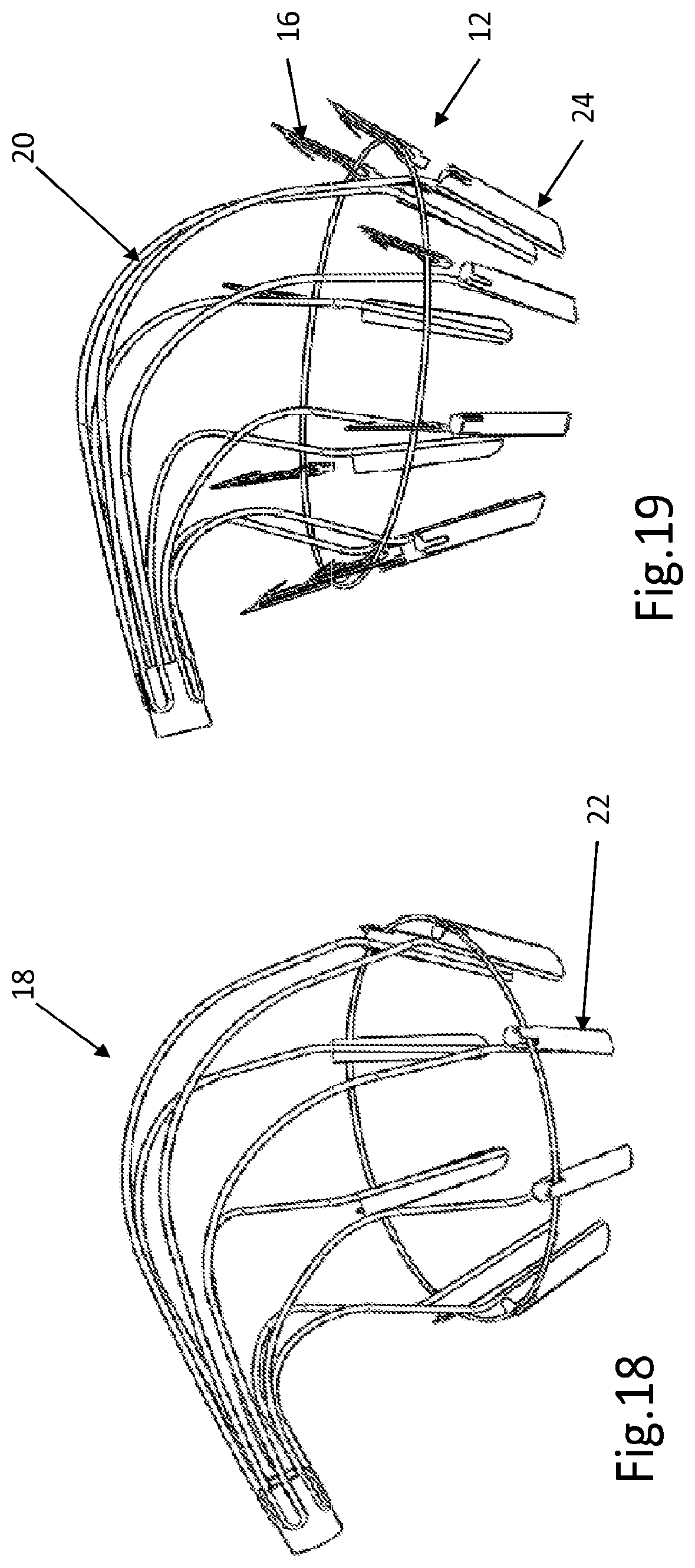 Patent US12508129 Figure 14 – Cardiac valve replacement