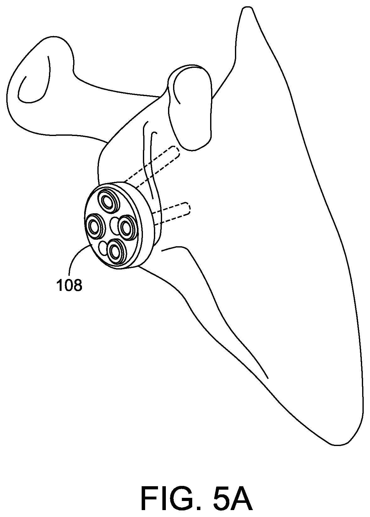 Patent US12508130 Figure 6 – Glenoid implant components and instruments therefor