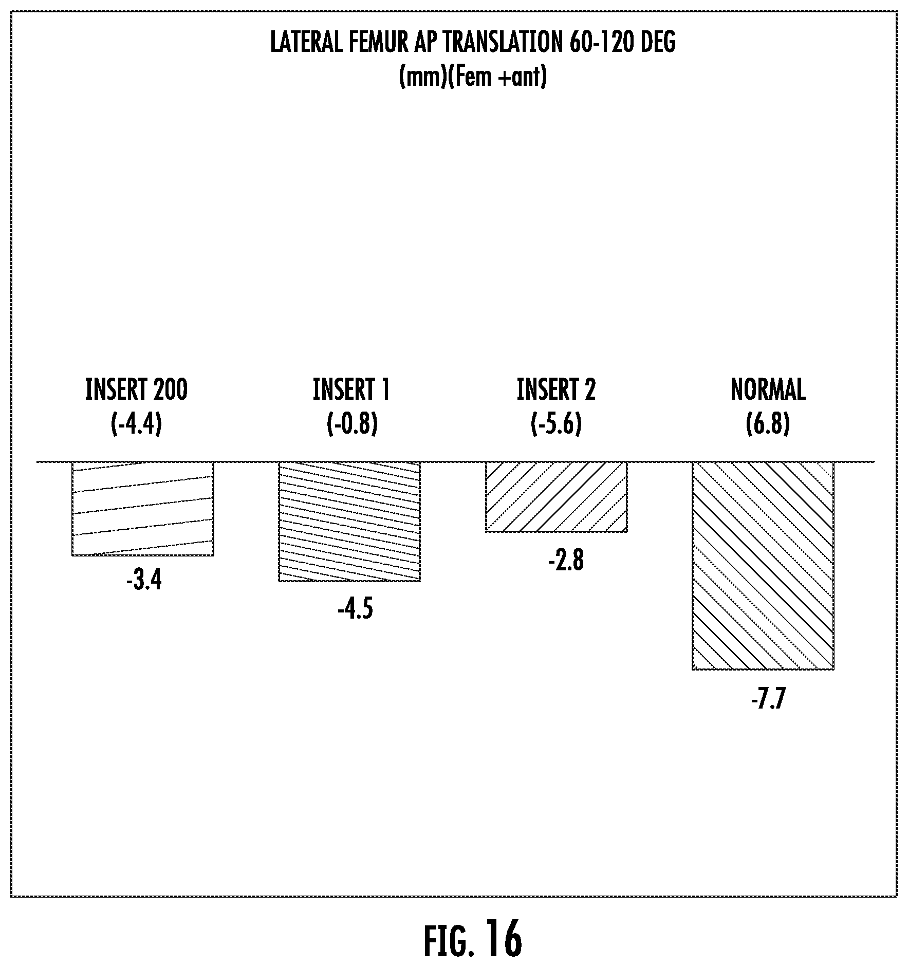 Patent US12508131 Figure 11 – Insert for use in a knee prosthesis