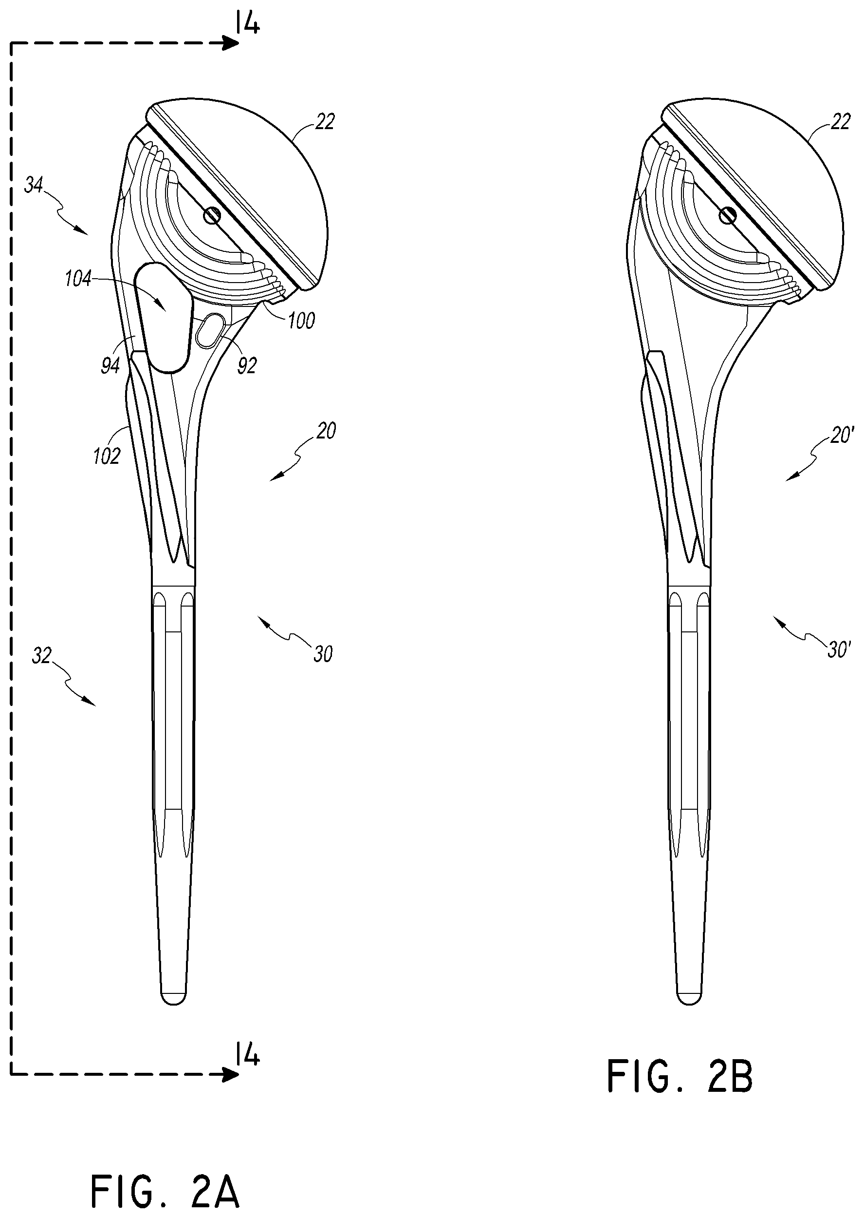 Patent US12508132 Figure 2 – Convertible stem/fracture stem