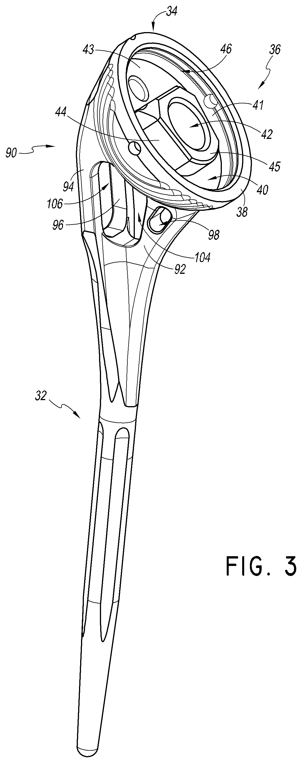 Patent US12508132 Figure 3 – Convertible stem/fracture stem