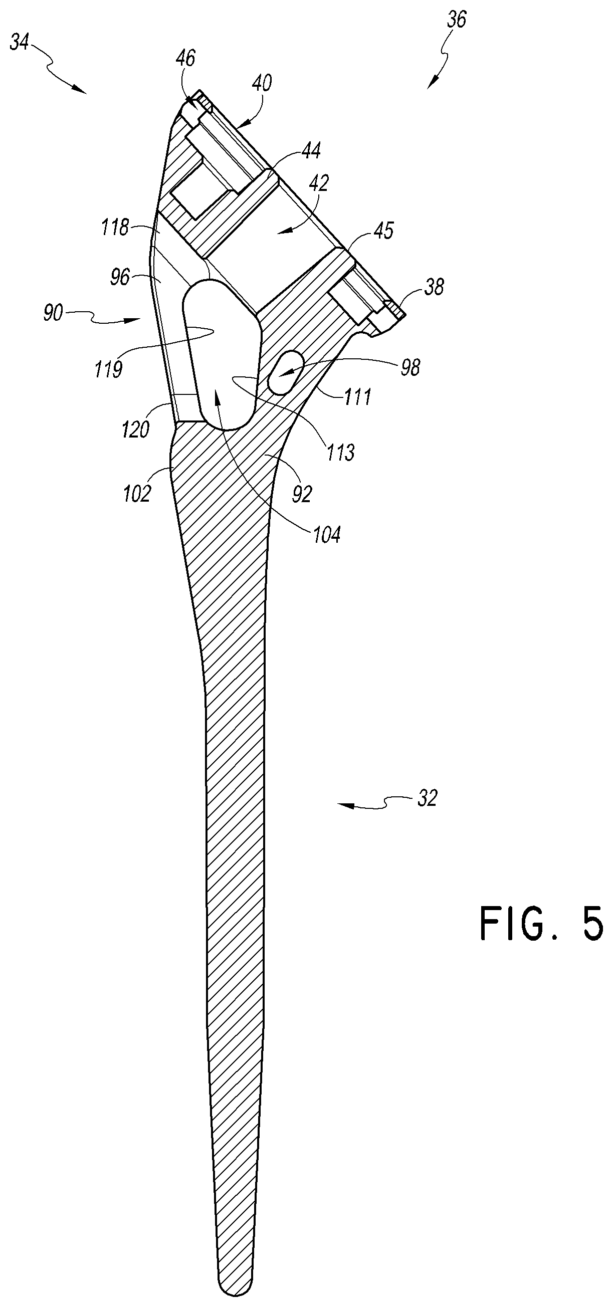 Patent US12508132 Figure 8 – Convertible stem/fracture stem