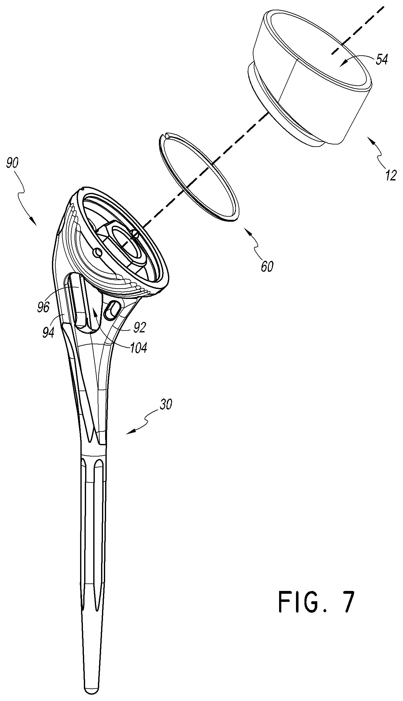 Patent US12508132 Figure 11 – Convertible stem/fracture stem