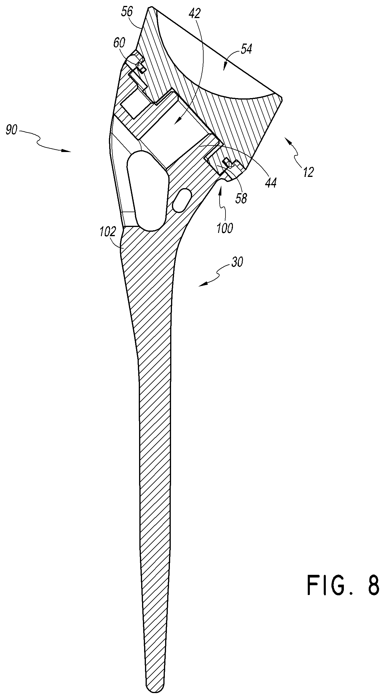 Patent US12508132 Figure 12 – Convertible stem/fracture stem