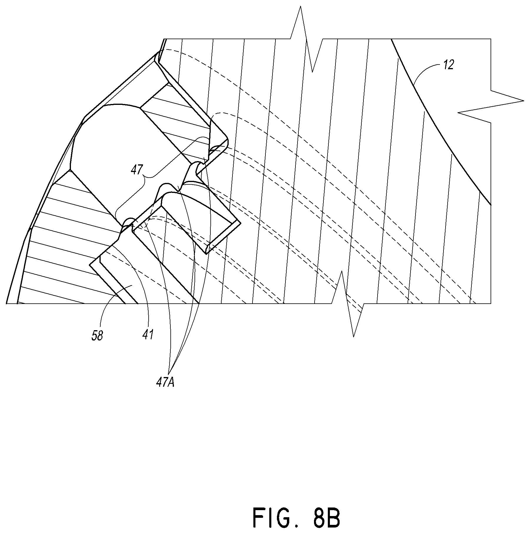 Patent US12508132 Figure 14 – Convertible stem/fracture stem