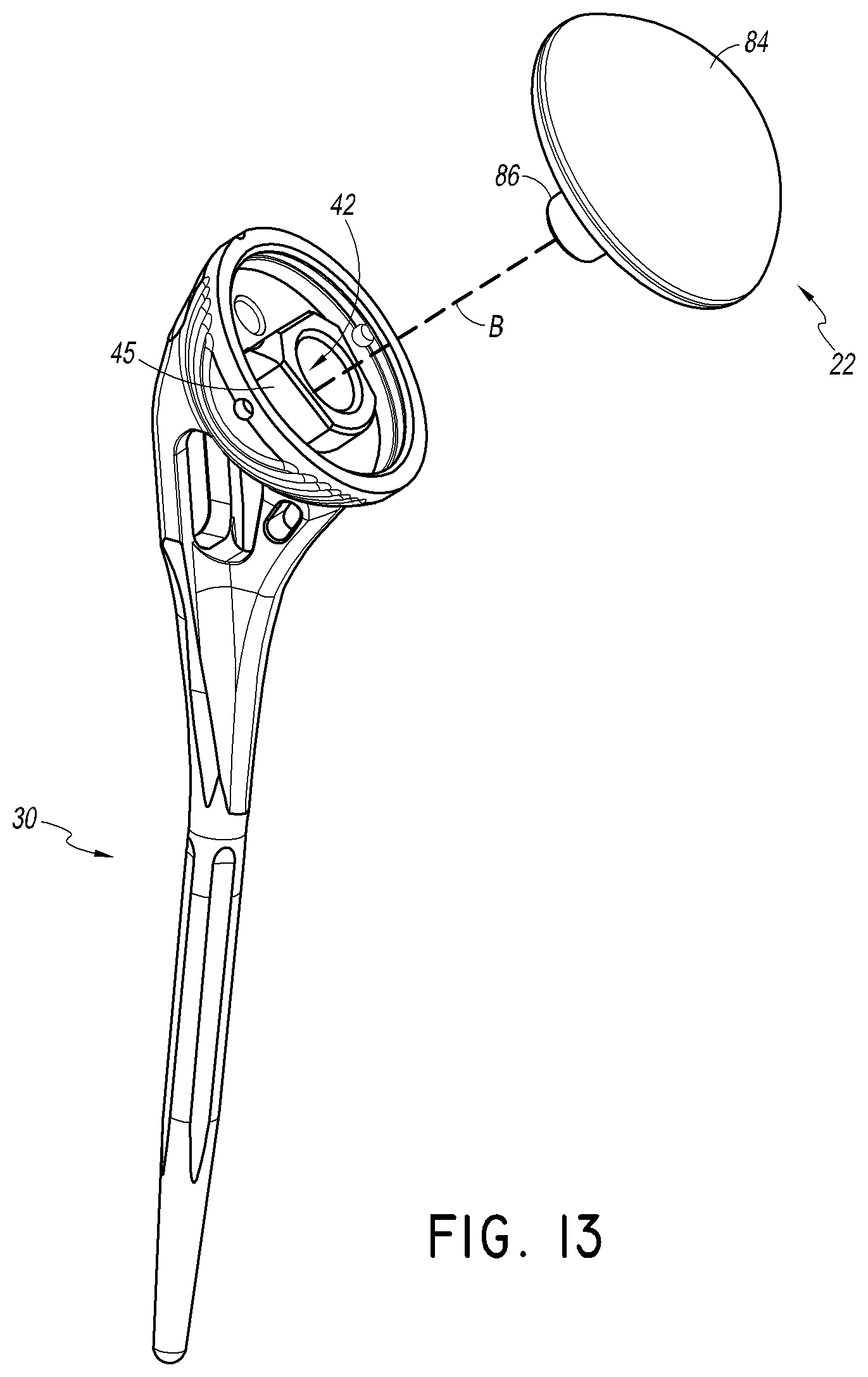 Patent US12508132 Figure 17 – Convertible stem/fracture stem
