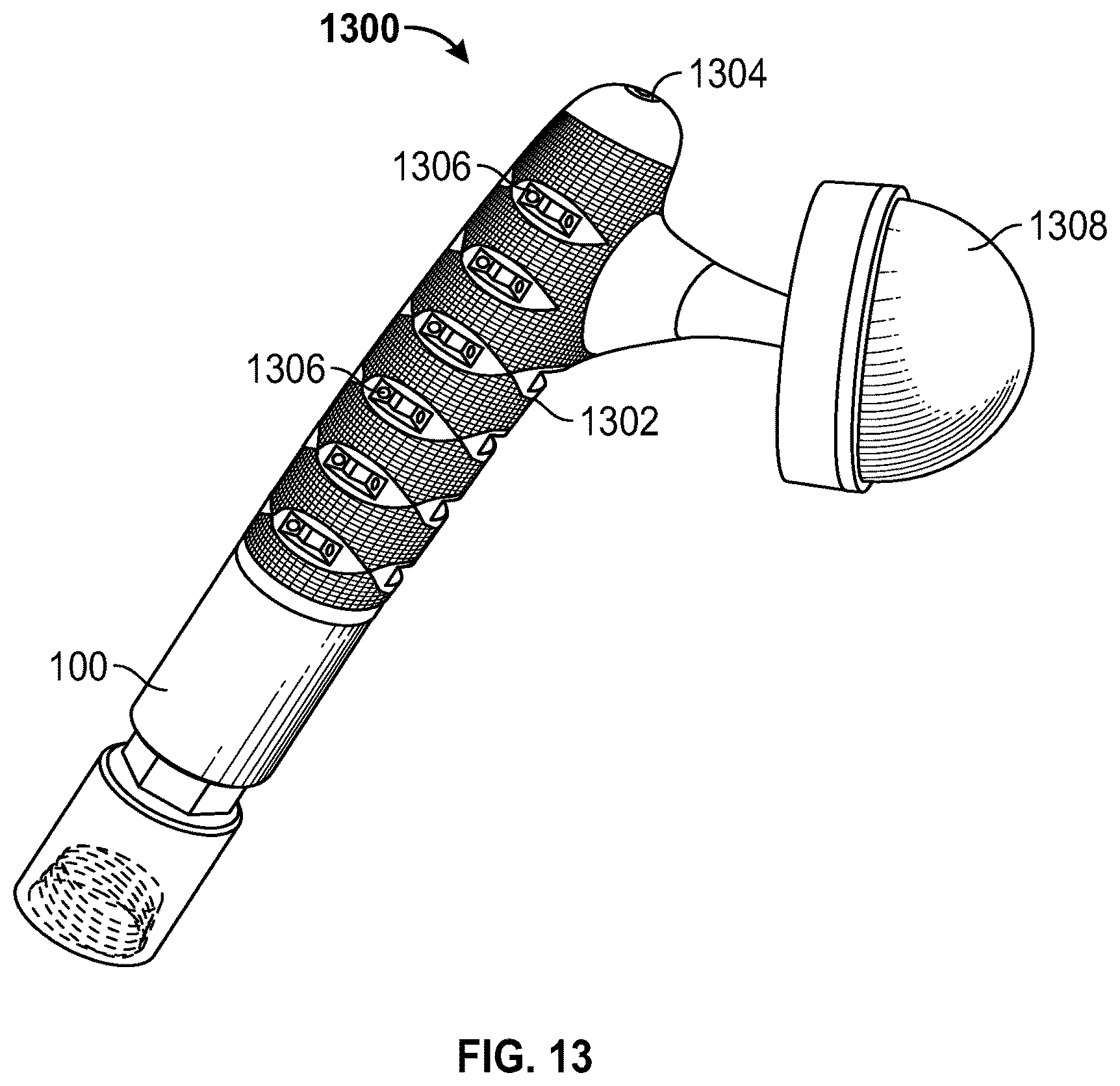 Patent US12508133 Figure 9 – Prosthesis surface treatment for soft tissue attachment thereto