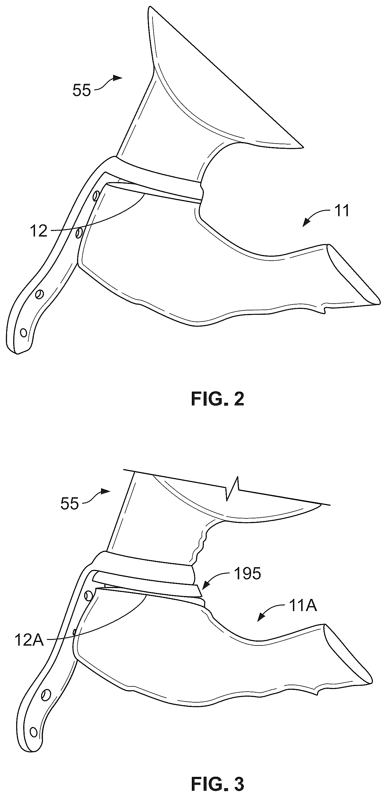 Patent US12508134 Figure 2 – Augmented, just-in-time, patient-specific implant manufacture