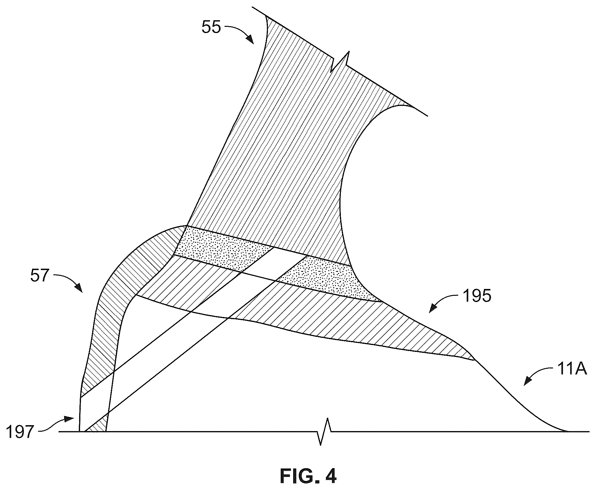 Patent US12508134 Figure 3 – Augmented, just-in-time, patient-specific implant manufacture