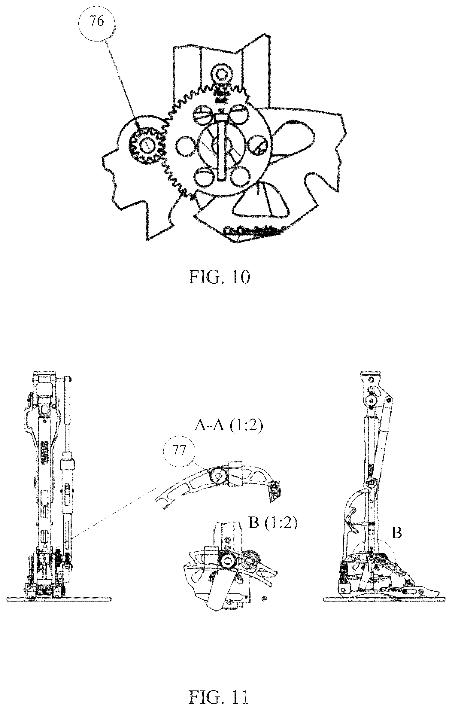 Patent US12508136 Figure 17 – Transfemoral prosthesis for walking, sitting- standing, stair climbing