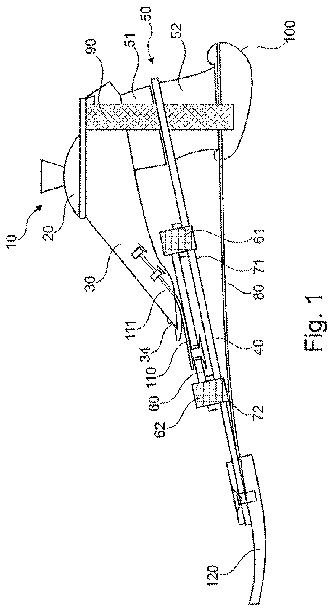 Patent US12508137 Figure 1 – Prosthetic foot component