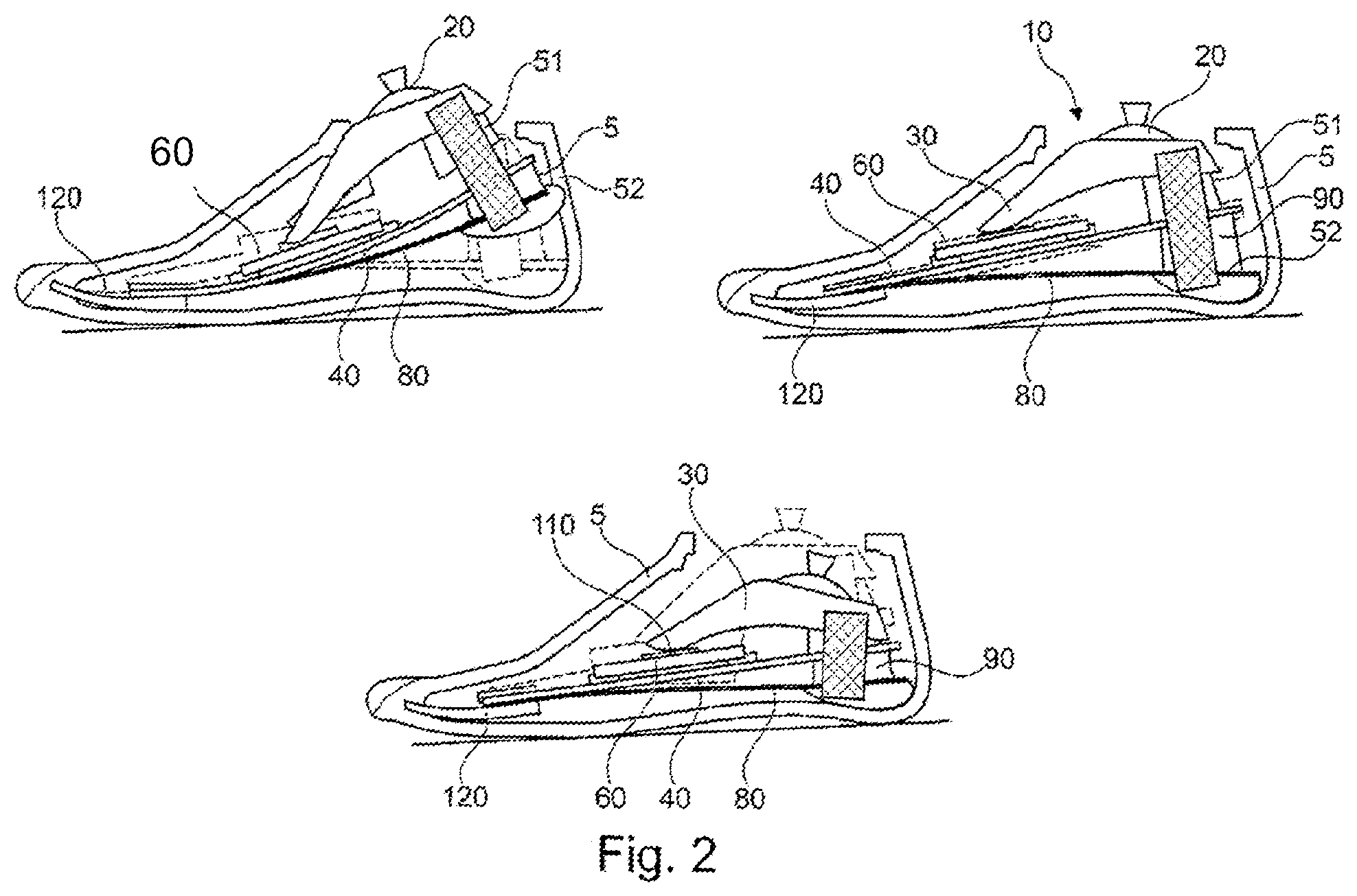 Patent US12508137 Figure 2 – Prosthetic foot component