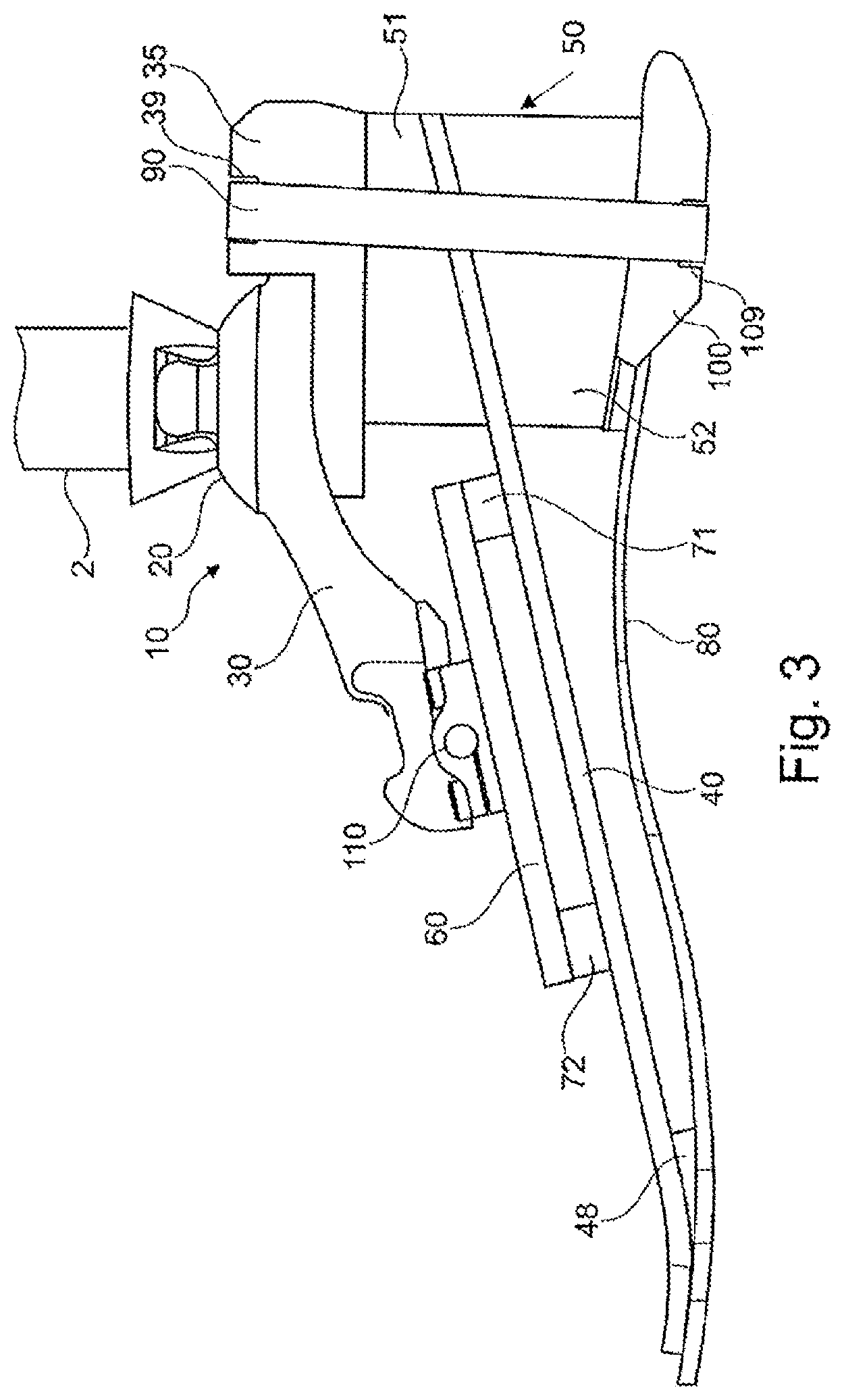 Patent US12508137 Figure 3 – Prosthetic foot component