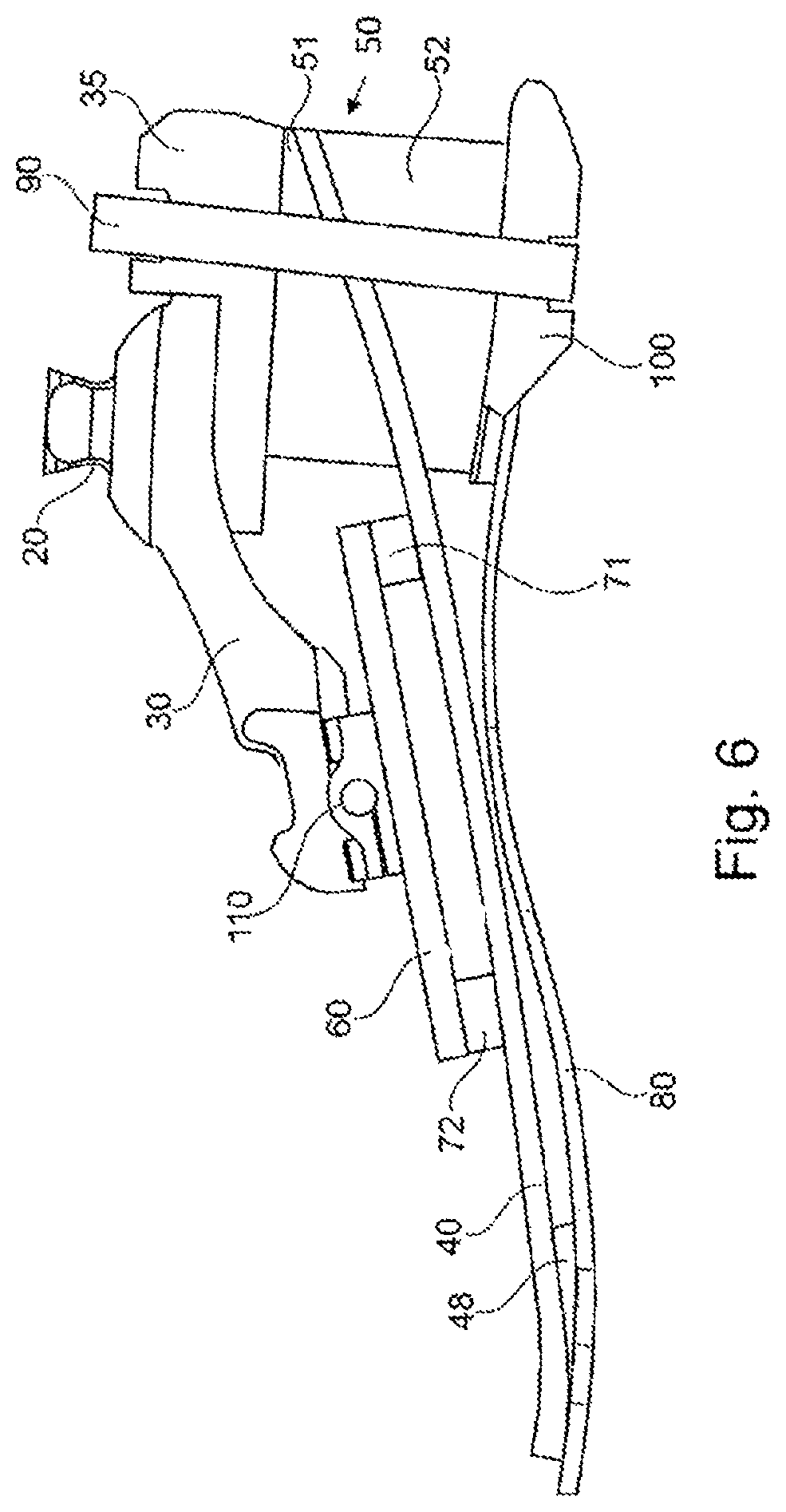 Patent US12508137 Figure 6 – Prosthetic foot component