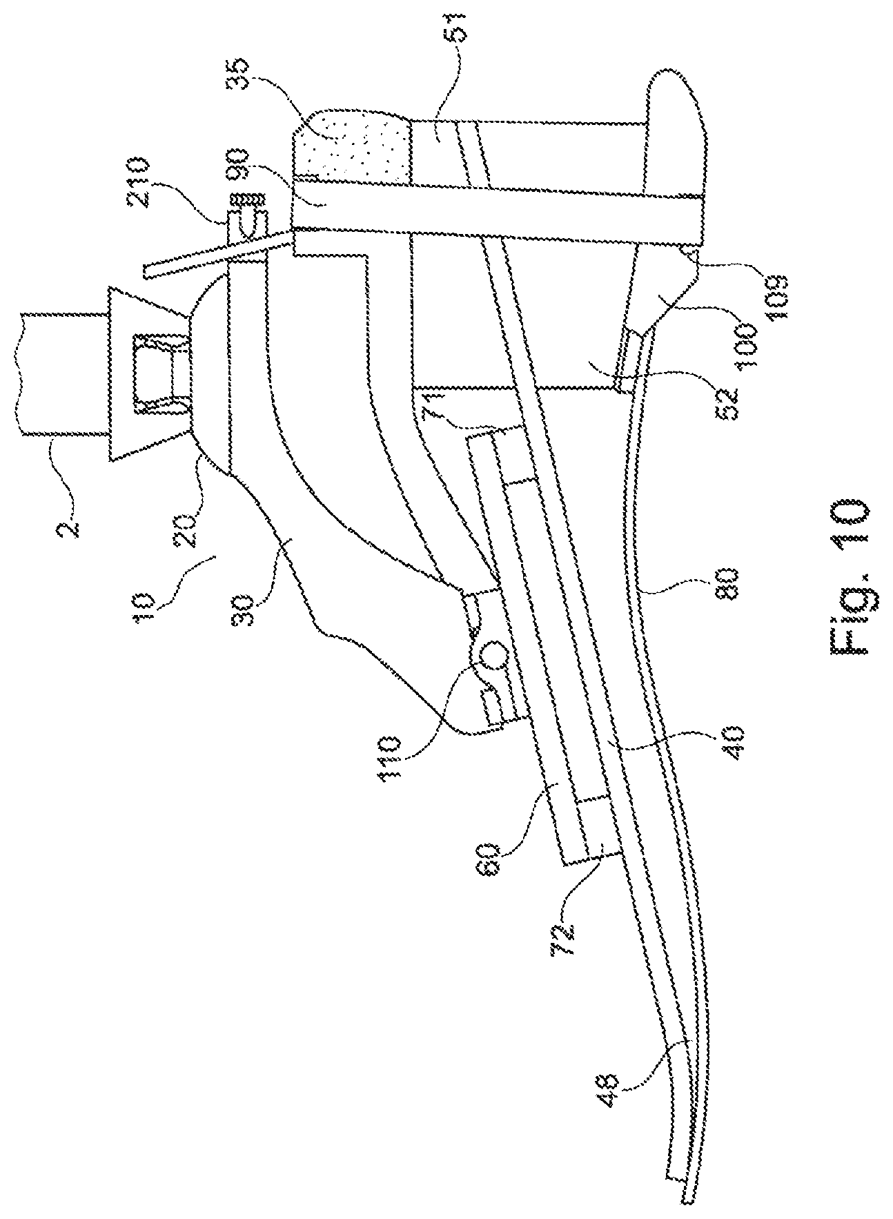 Patent US12508137 Figure 10 – Prosthetic foot component