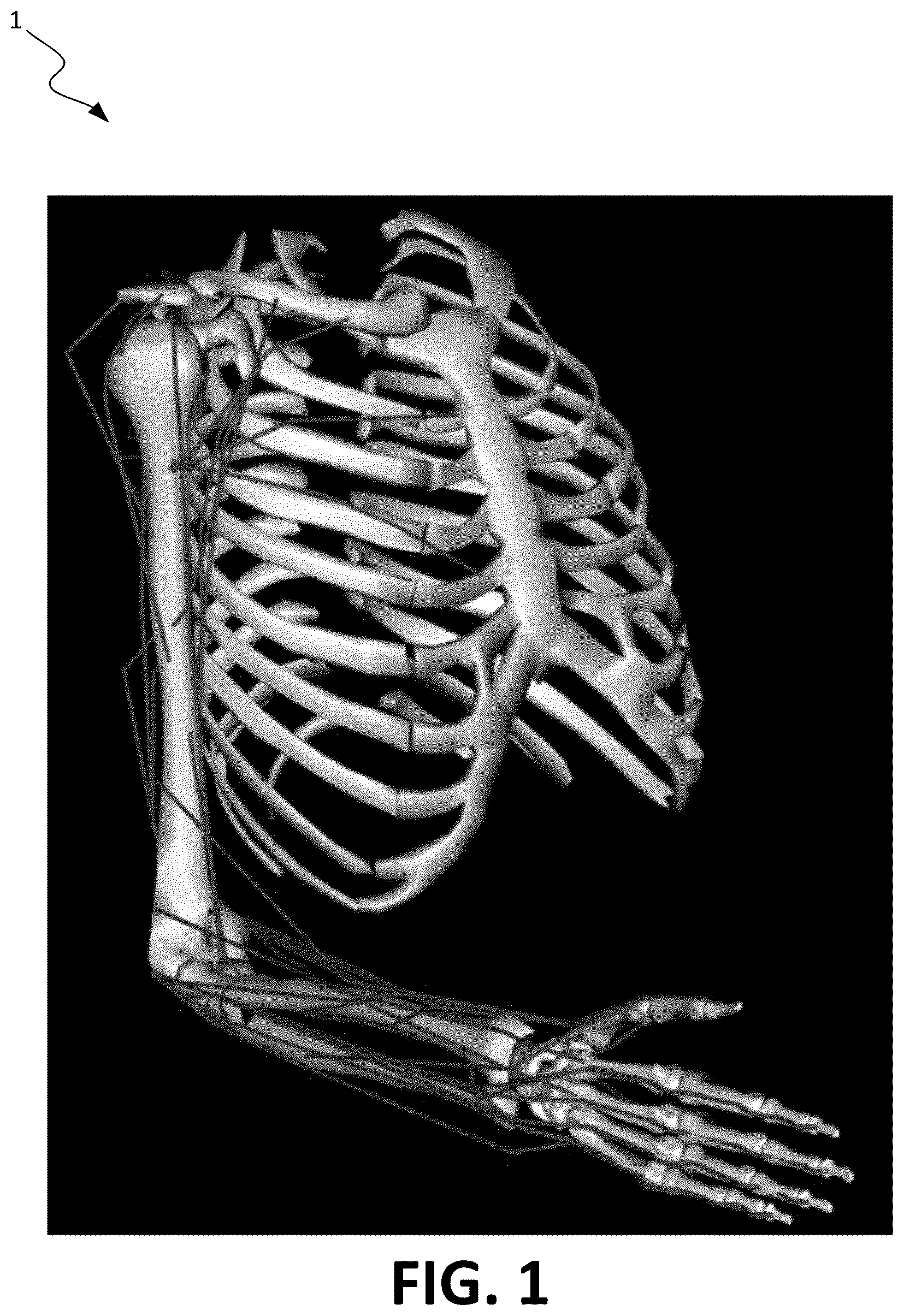Patent US12508138 Figure 1 – Systems and methods for approximating musculoskeletal dynamics