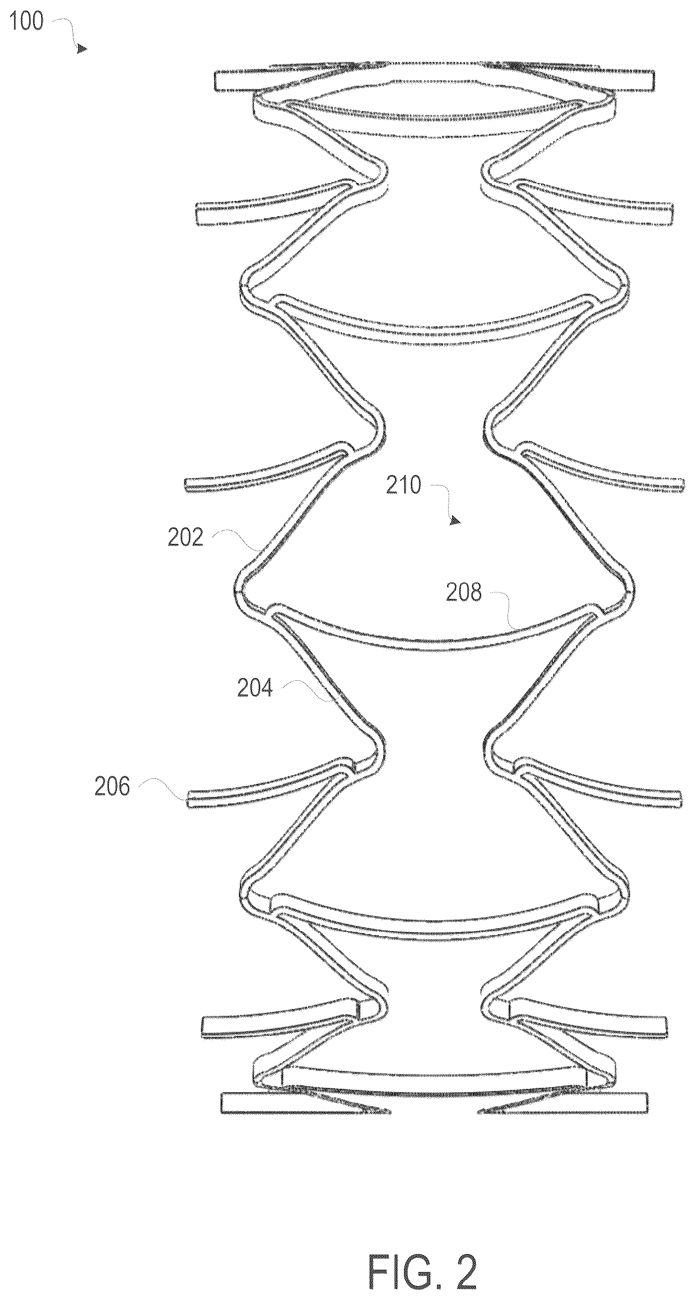 Patent US12508139 Figure 2 – Auxetic stents for managing venous stenosis