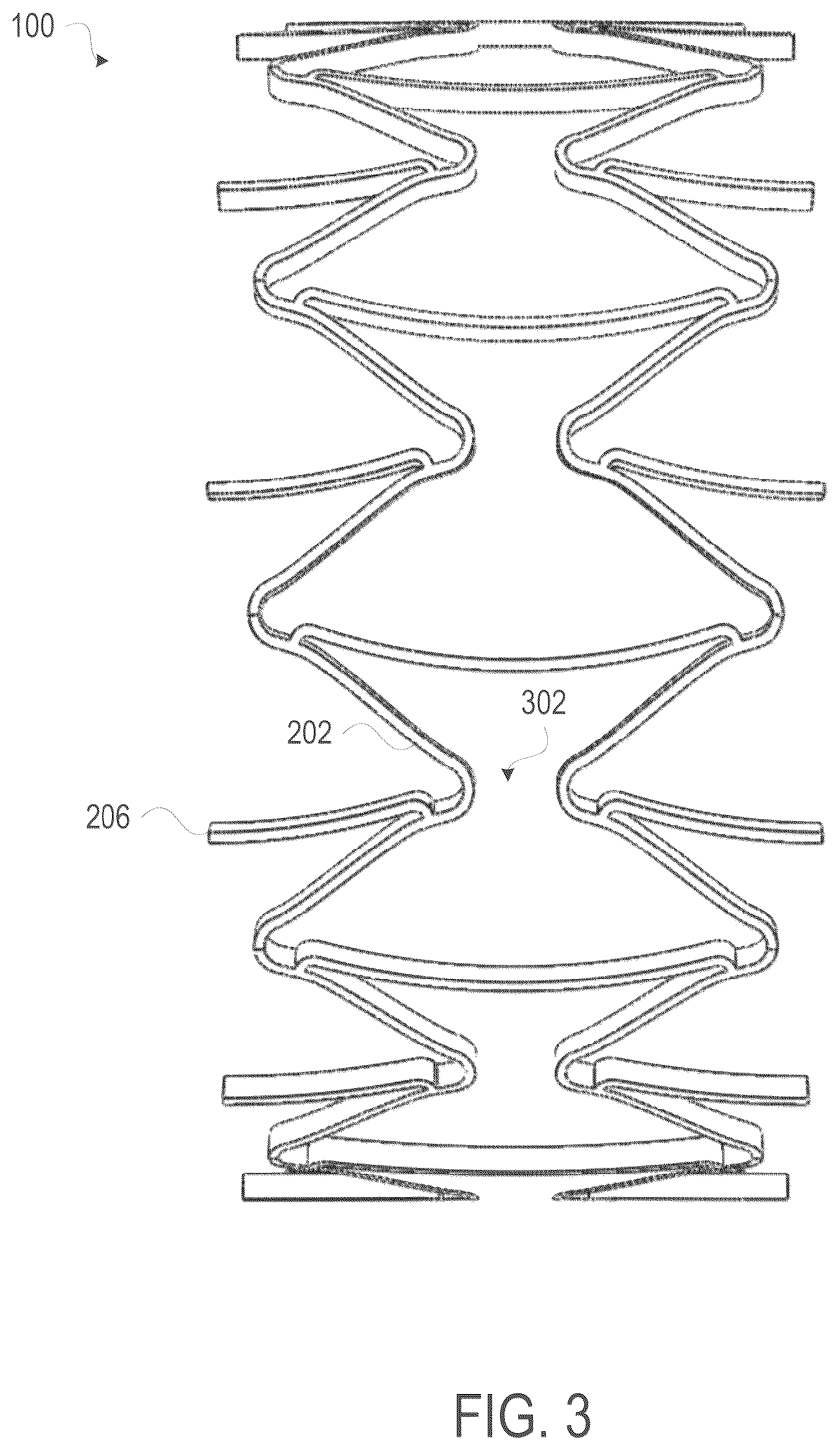 Patent US12508139 Figure 3 – Auxetic stents for managing venous stenosis