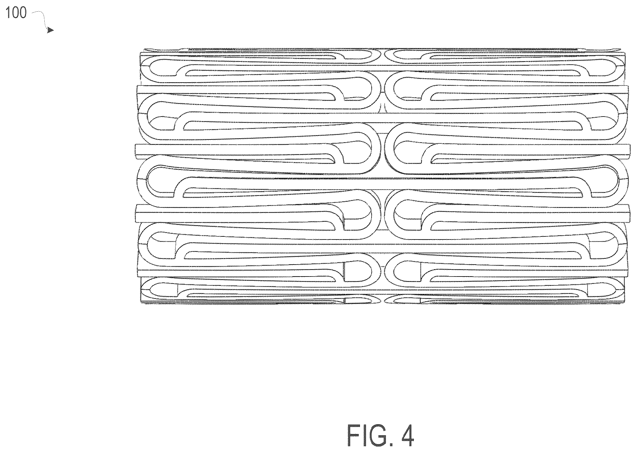 Patent US12508139 Figure 4 – Auxetic stents for managing venous stenosis