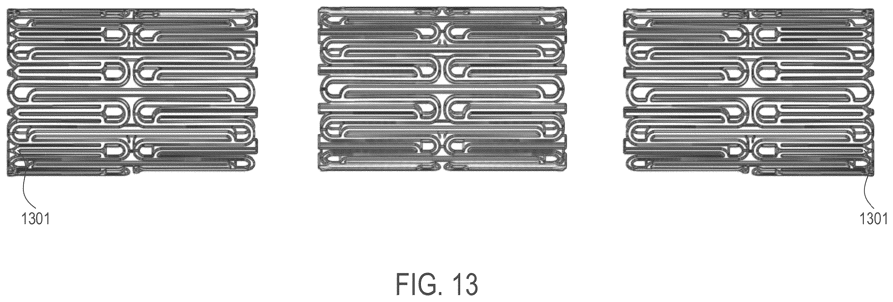 Patent US12508139 Figure 10 – Auxetic stents for managing venous stenosis