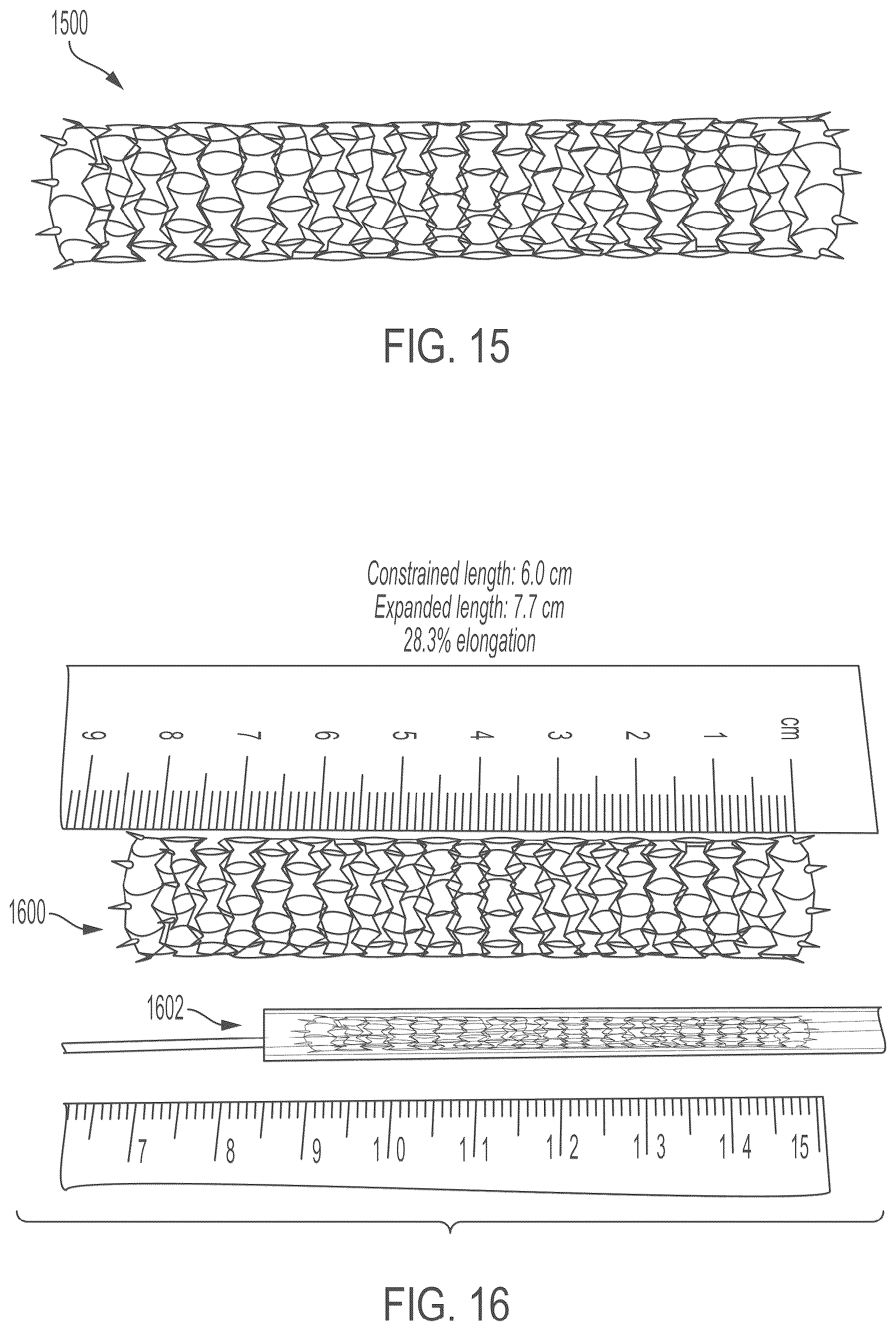 Patent US12508139 Figure 12 – Auxetic stents for managing venous stenosis