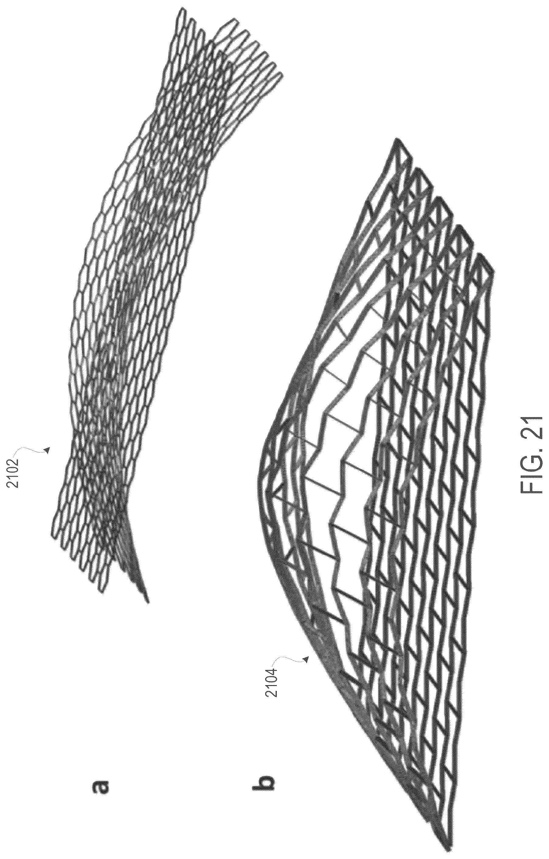 Patent US12508139 Figure 17 – Auxetic stents for managing venous stenosis
