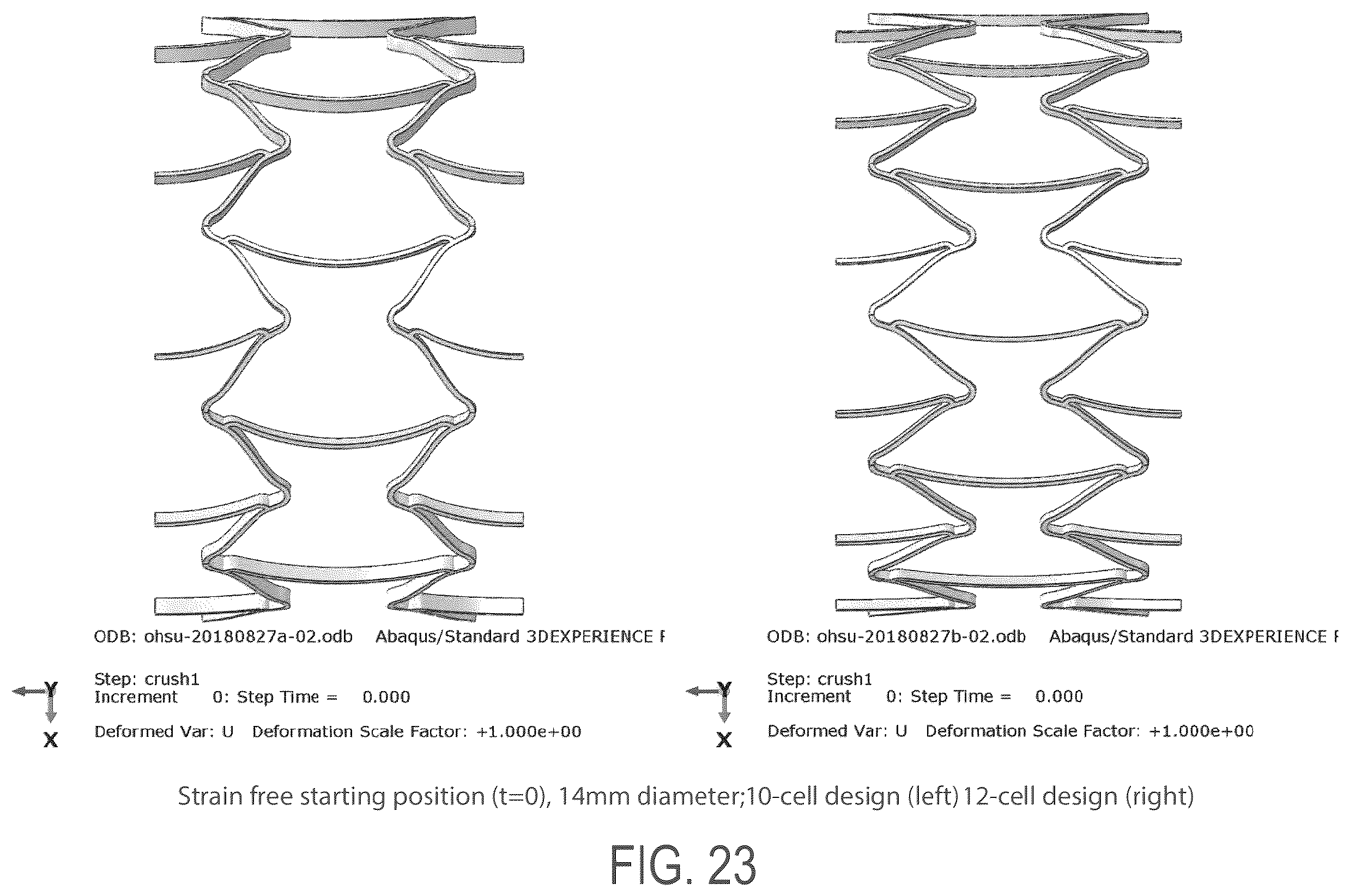 Patent US12508139 Figure 19 – Auxetic stents for managing venous stenosis