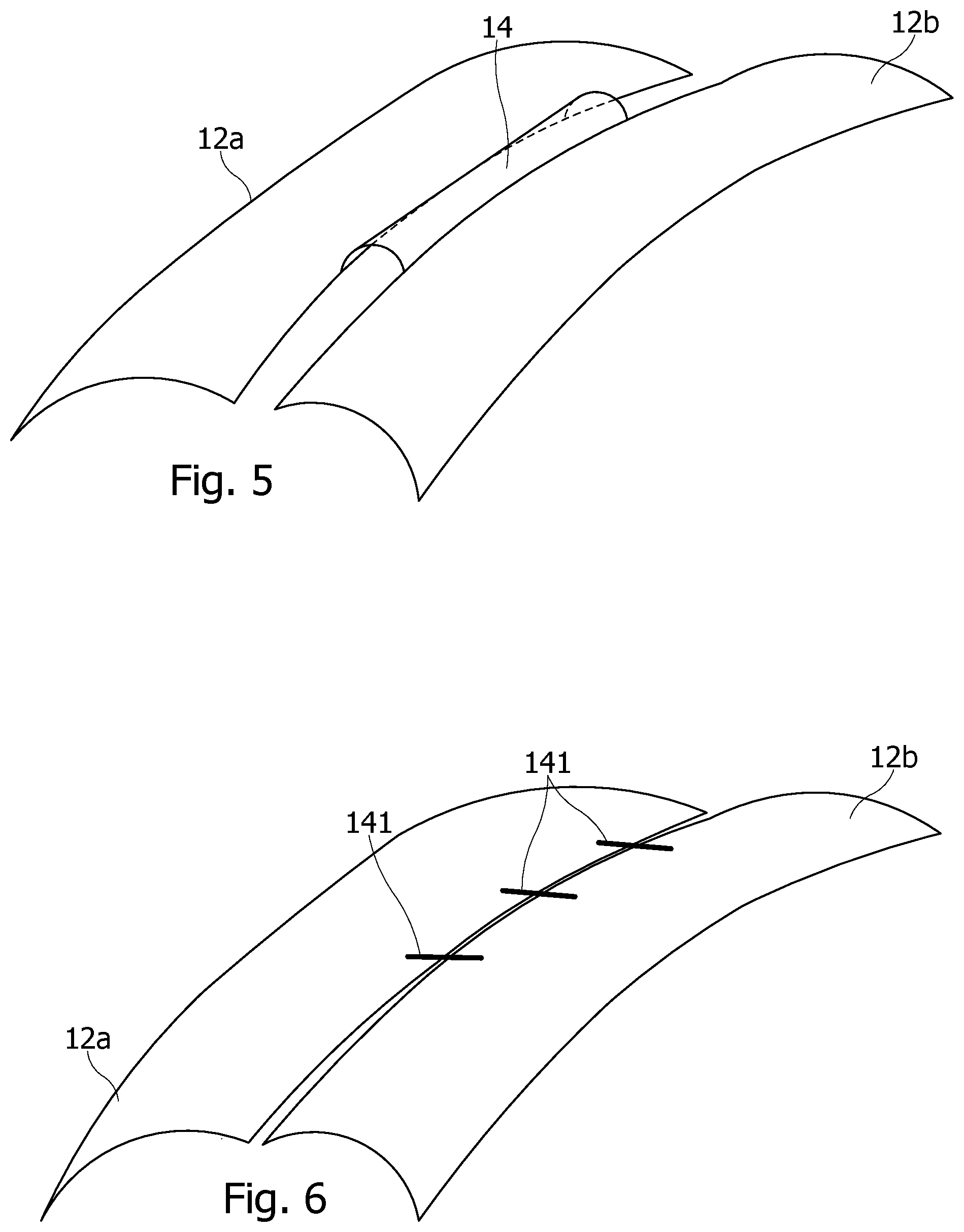 Patent US12508141 Figure 2 – Resting orthosis for a joint