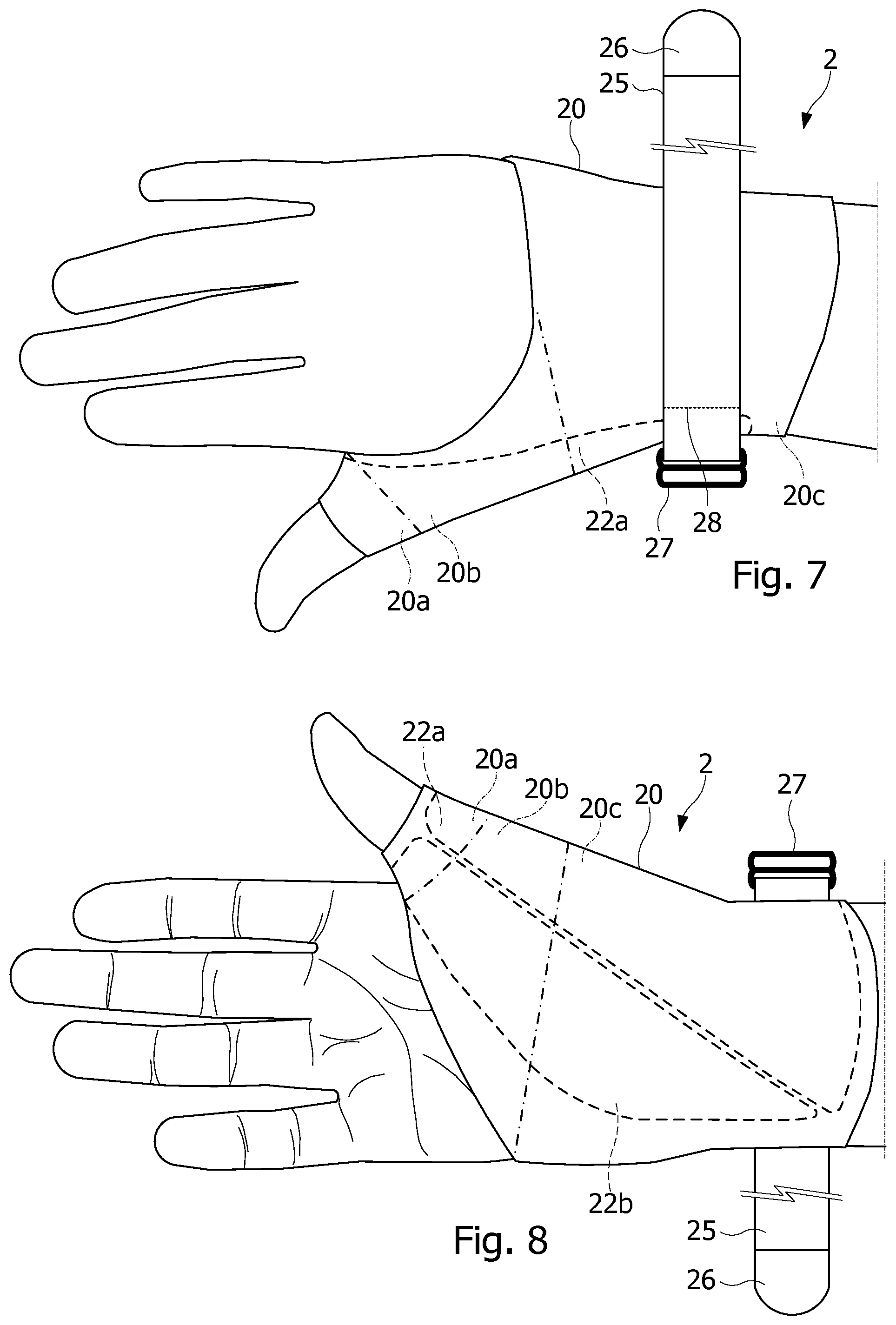 Patent US12508141 Figure 3 – Resting orthosis for a joint