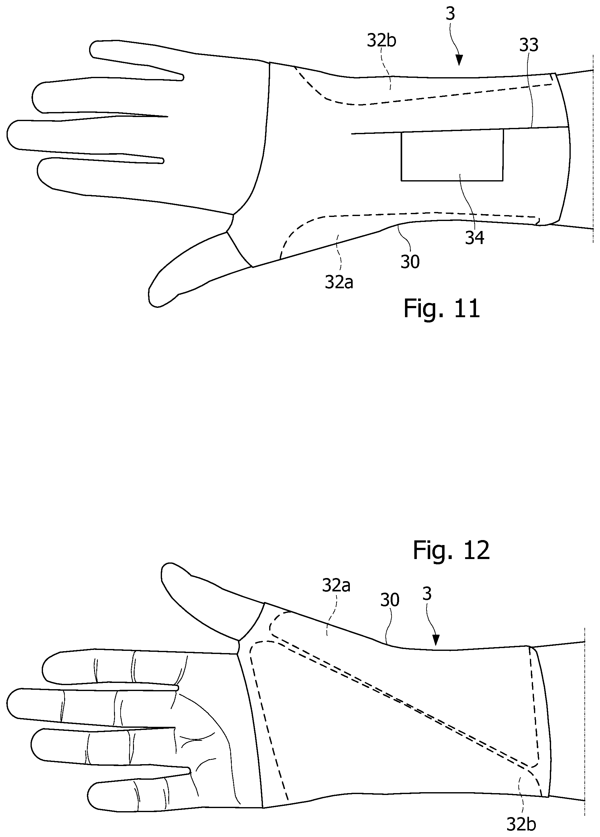 Patent US12508141 Figure 5 – Resting orthosis for a joint
