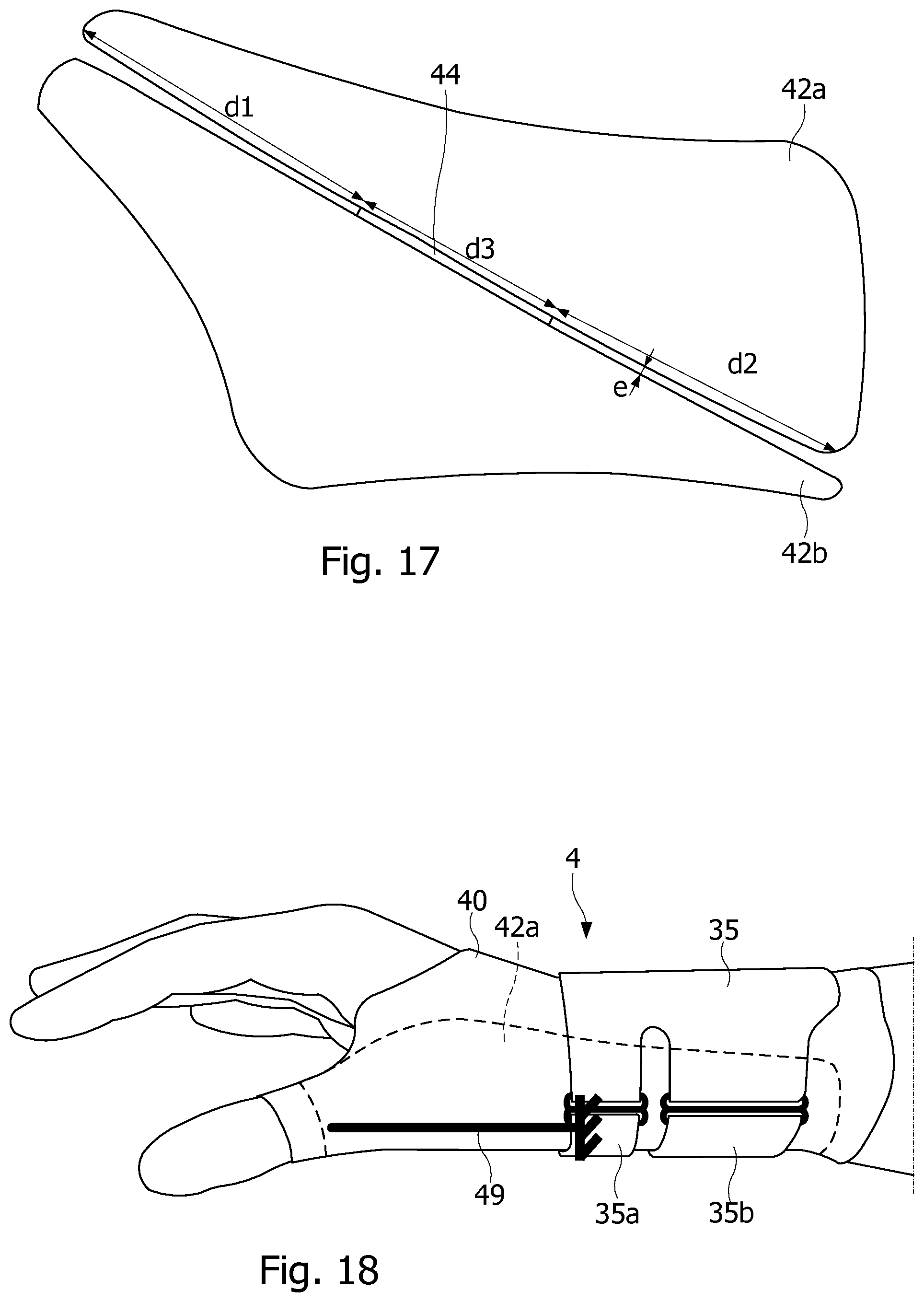 Patent US12508141 Figure 8 – Resting orthosis for a joint