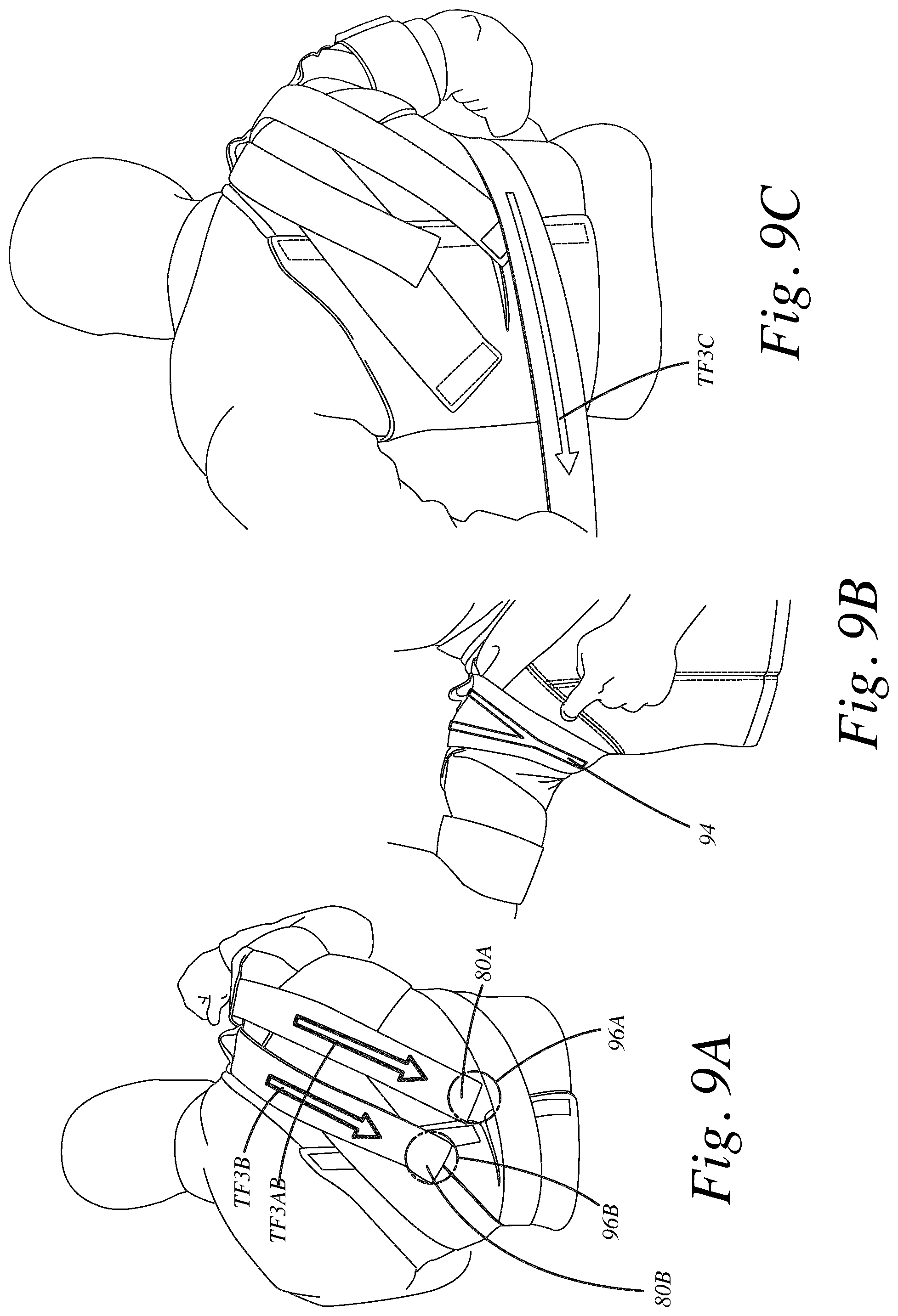 Patent US12508142 Figure 8 – Dynamic tensioning reversible orthosis, hammock strap, and related method of use