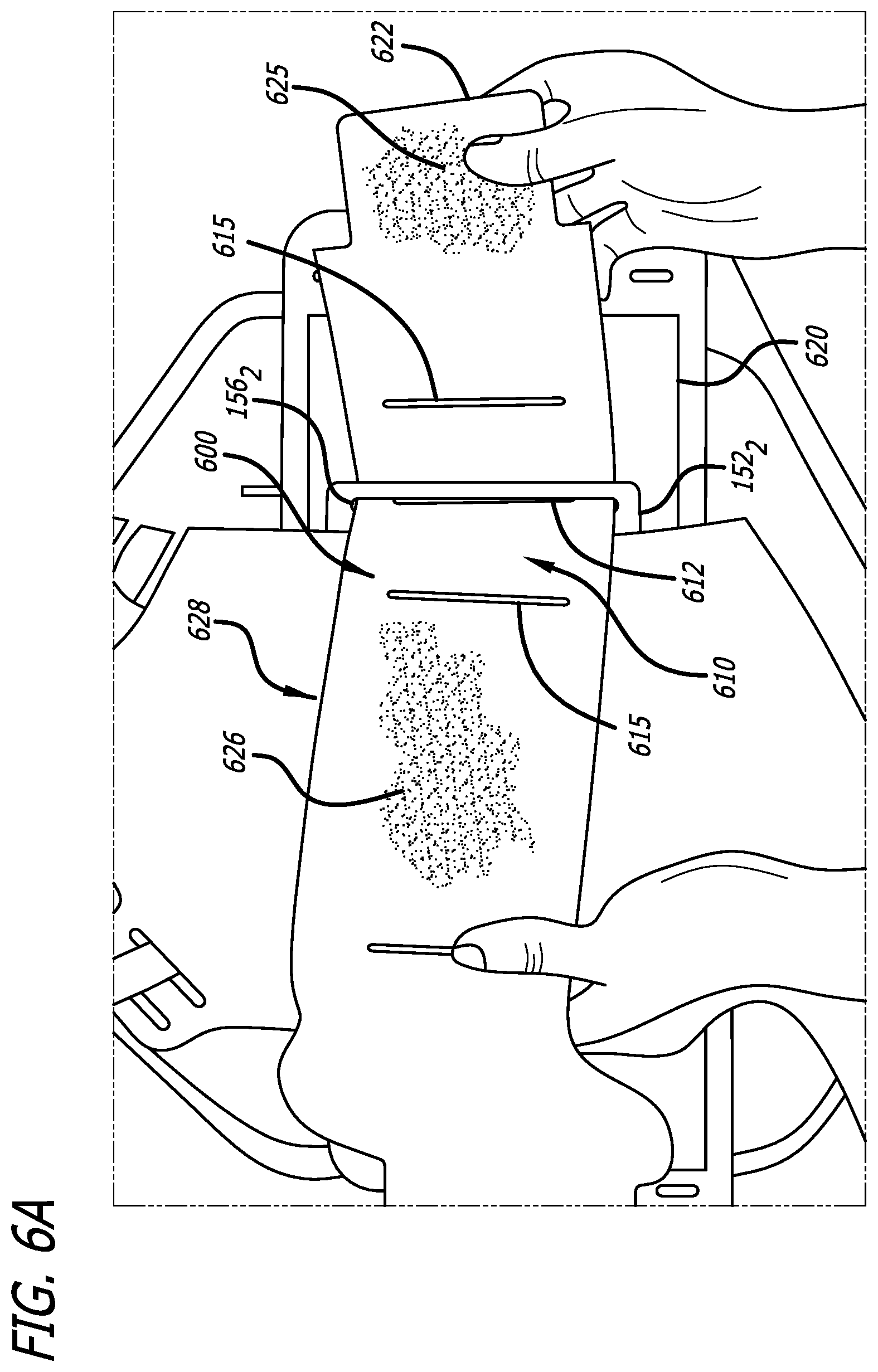 Patent US12508145 Figure 13 – Orthopedic brace and donning method