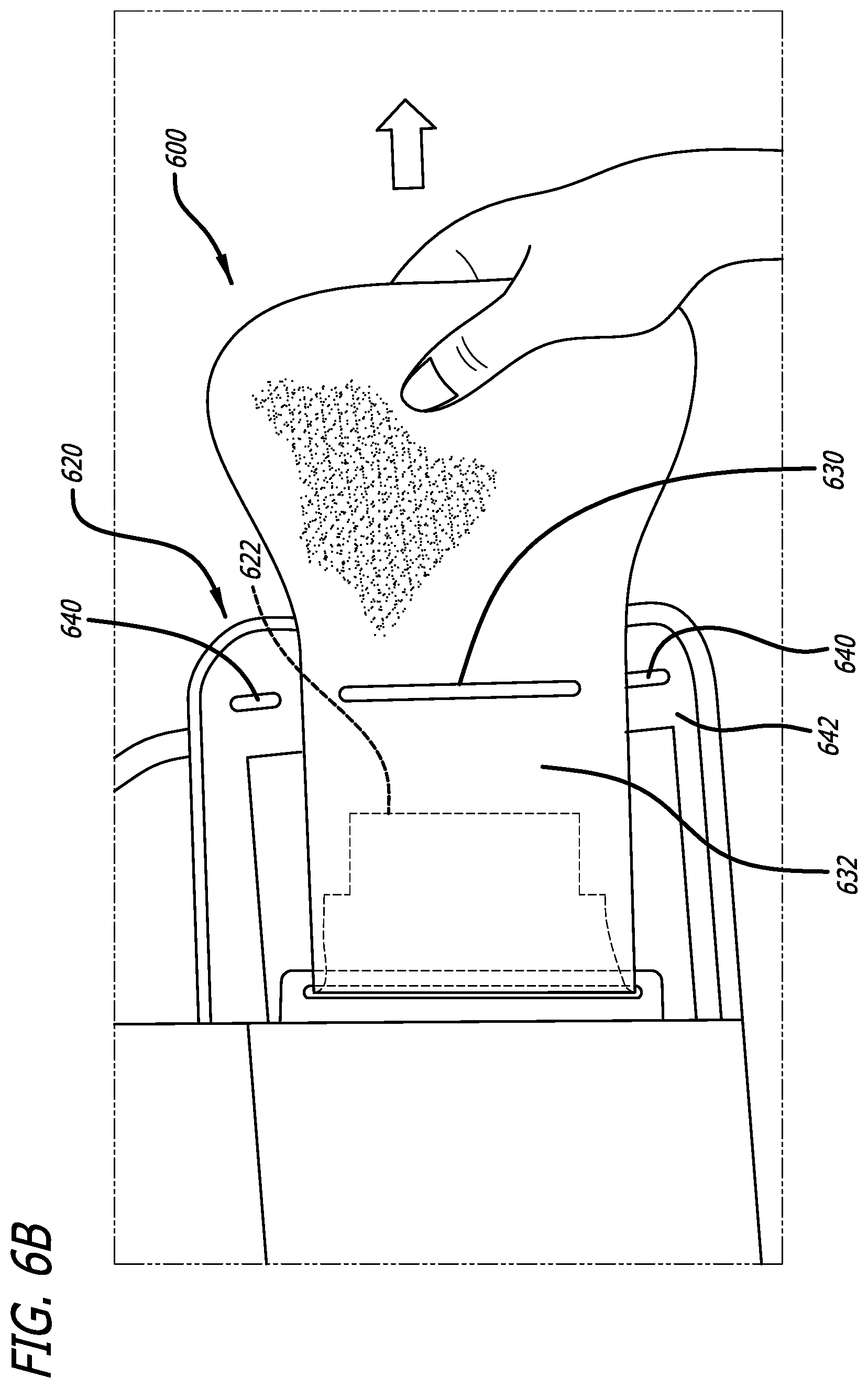 Patent US12508145 Figure 14 – Orthopedic brace and donning method