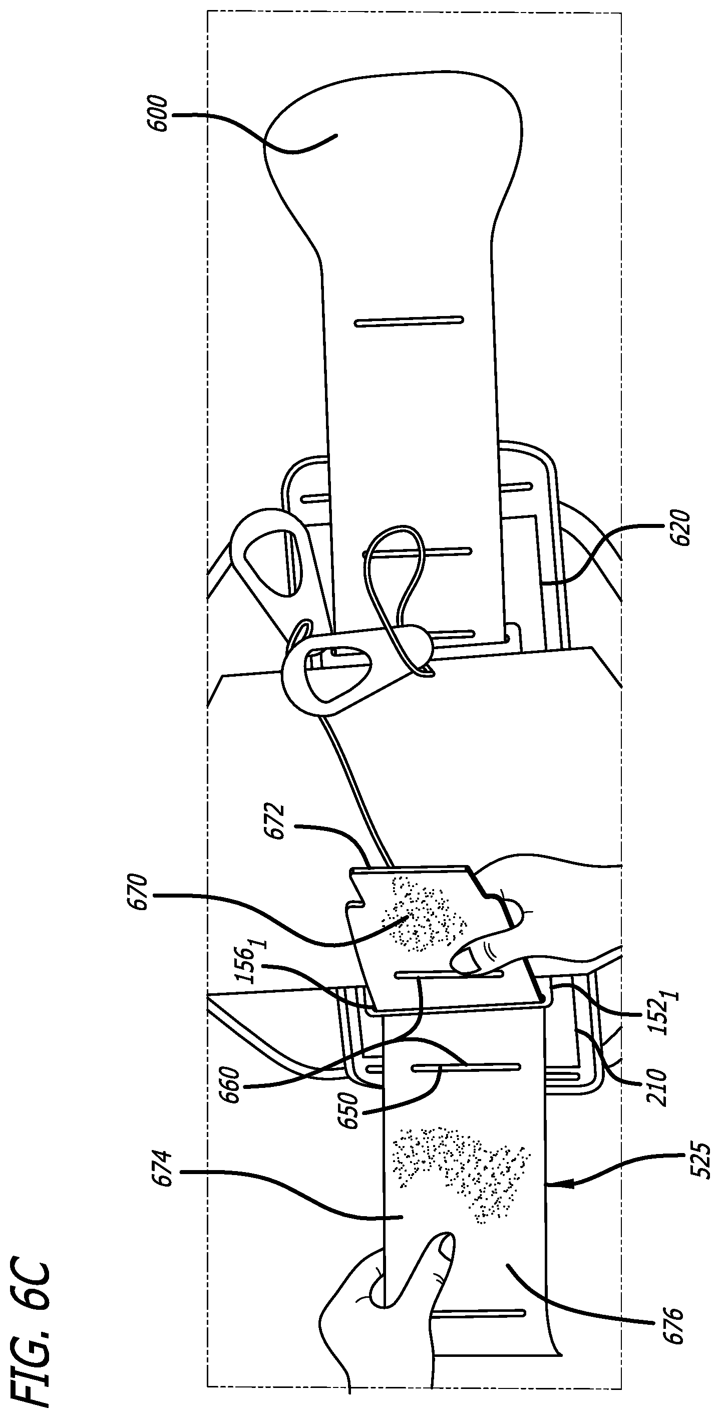 Patent US12508145 Figure 15 – Orthopedic brace and donning method