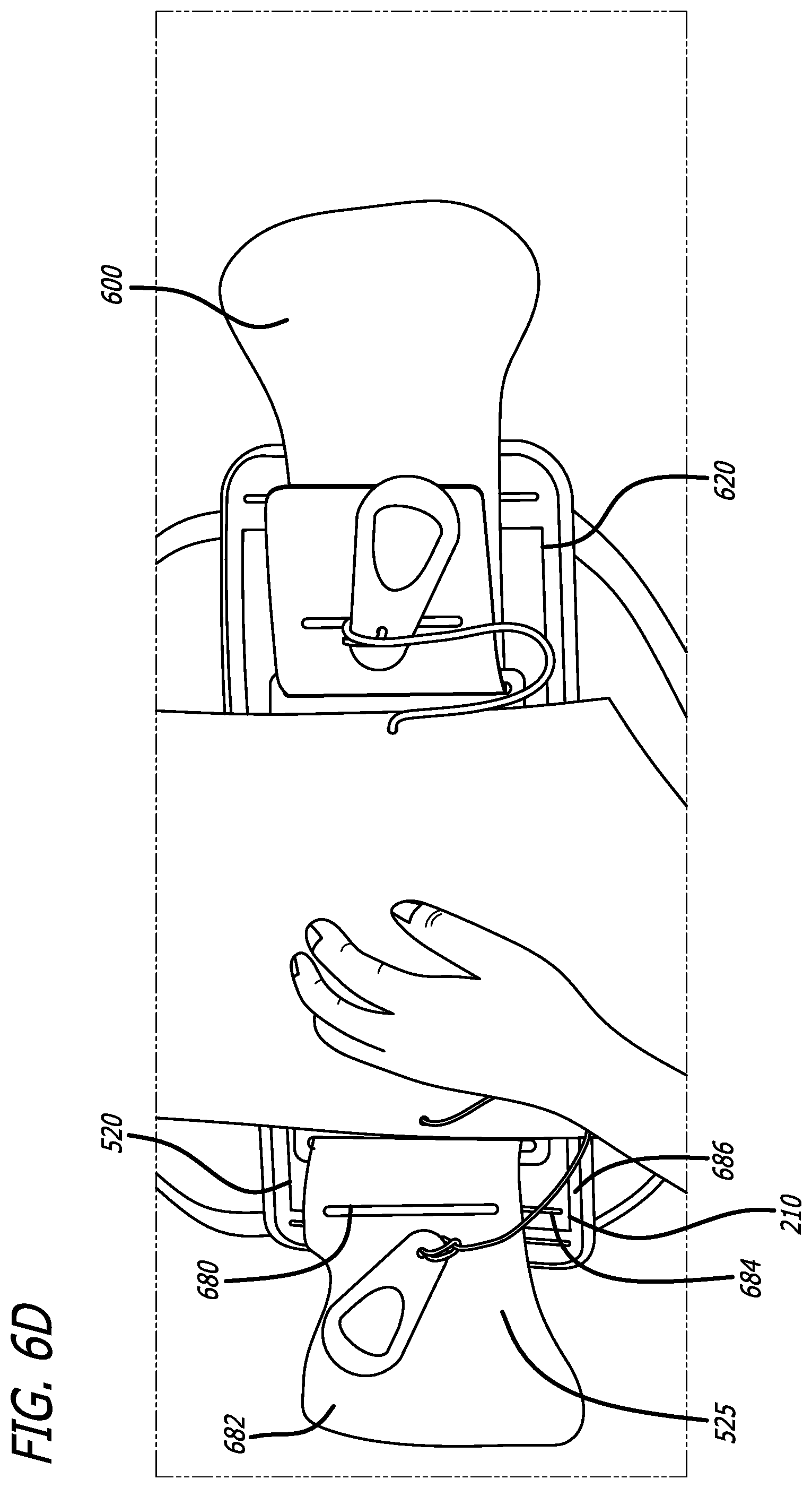 Patent US12508145 Figure 16 – Orthopedic brace and donning method
