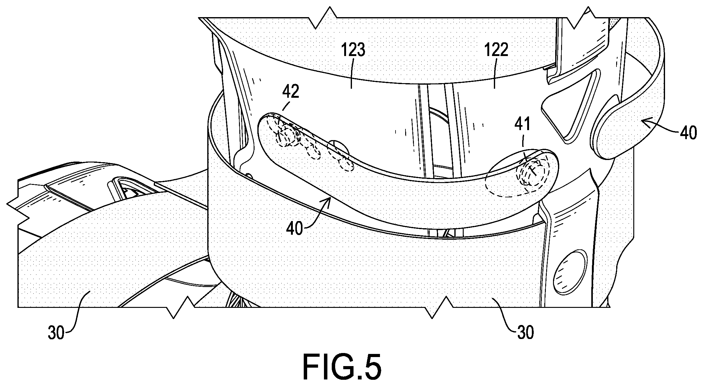 Patent US12508147 Figure 5 – Rehabilitation boot