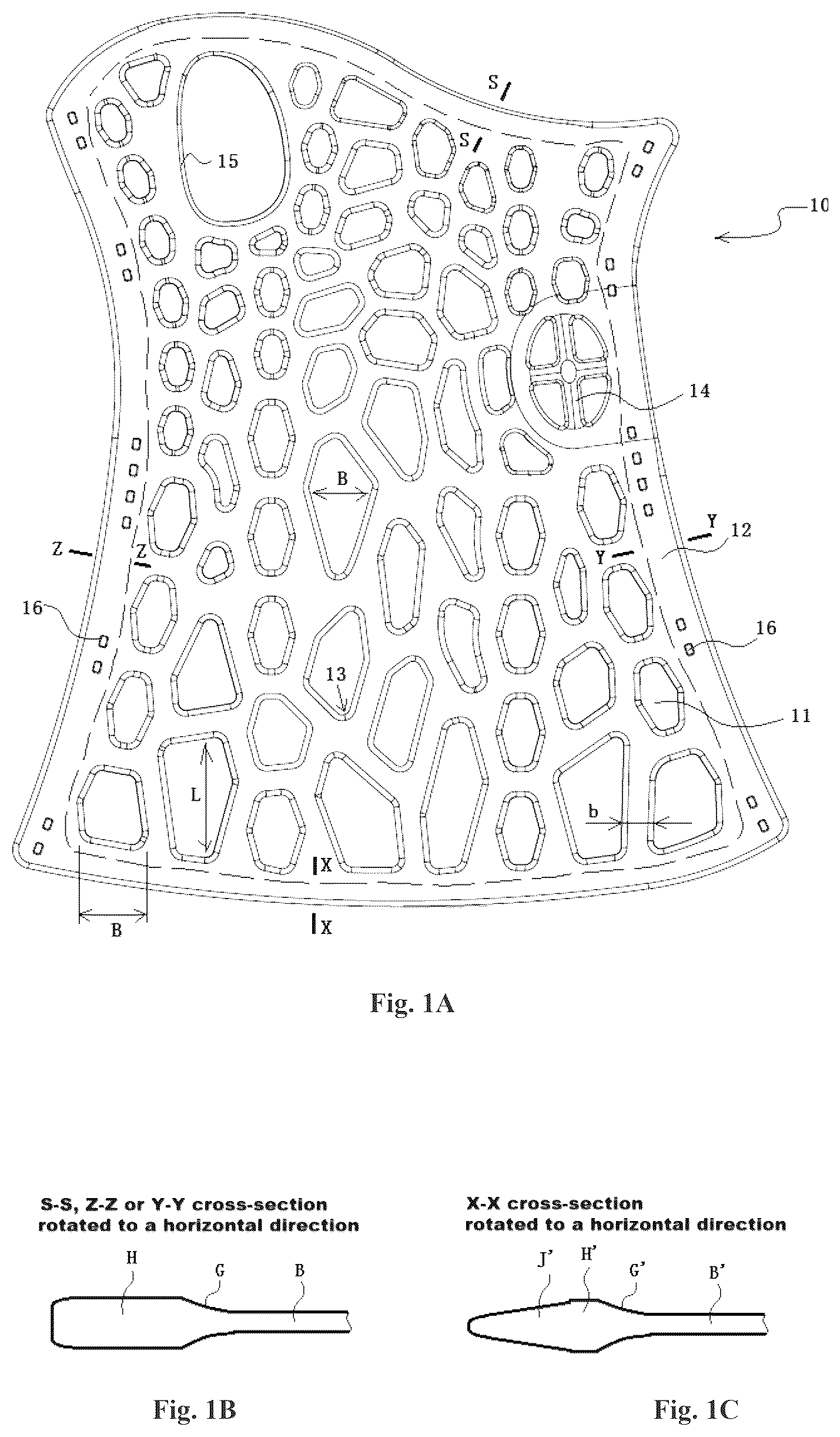 Patent US12508148 Figure 1 – Easily formed arm external fixing brace