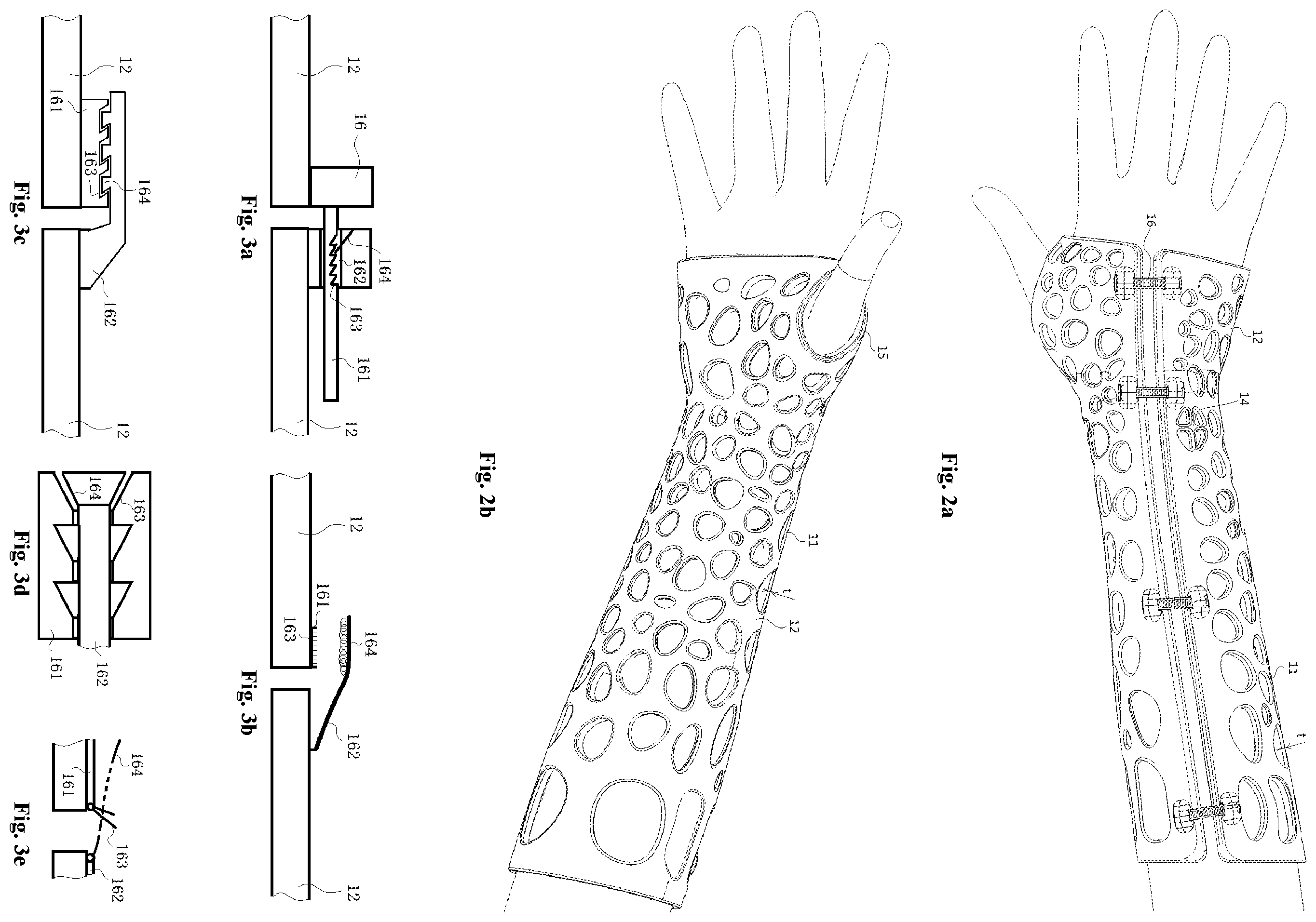 Patent US12508148 Figure 2 – Easily formed arm external fixing brace