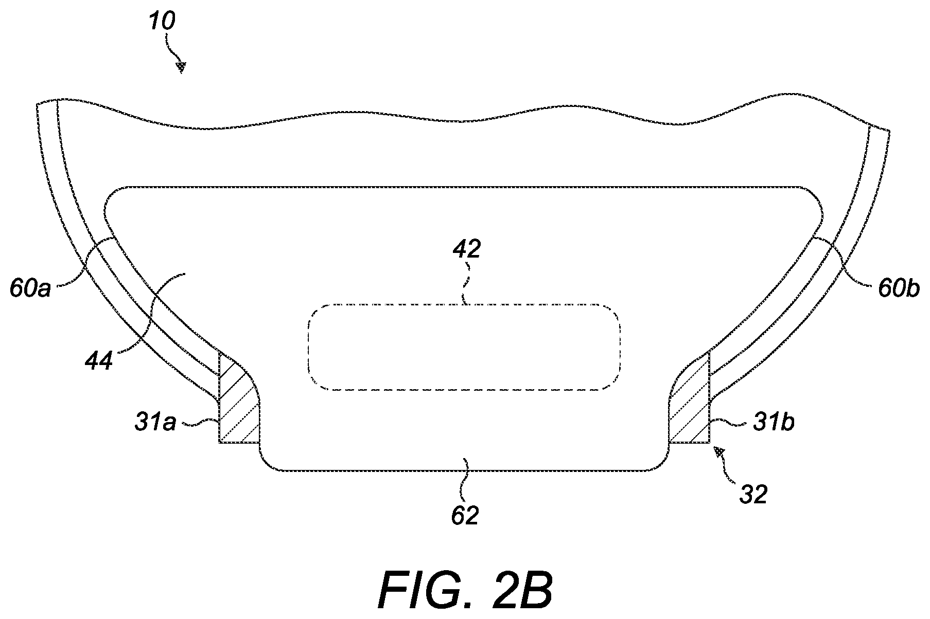 Patent US12508150 Figure 4 – Ostomy pouch