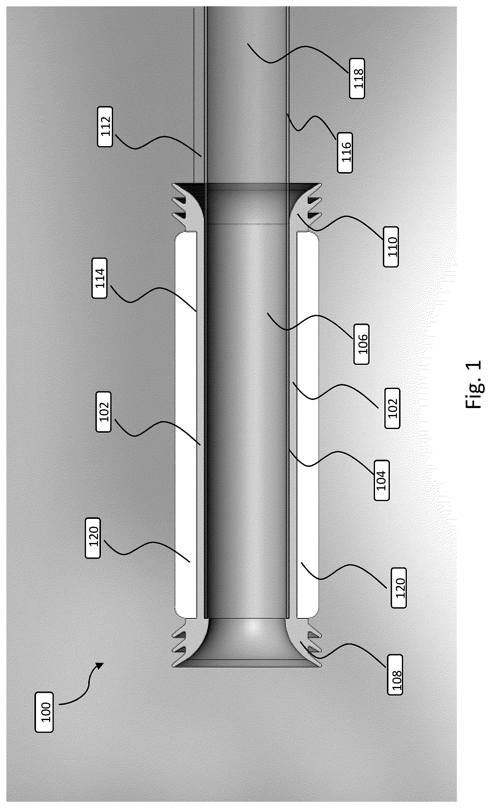 Patent US12508151 Figure 1 – Devices and methods for anchoring a sheath in a tissue cavity