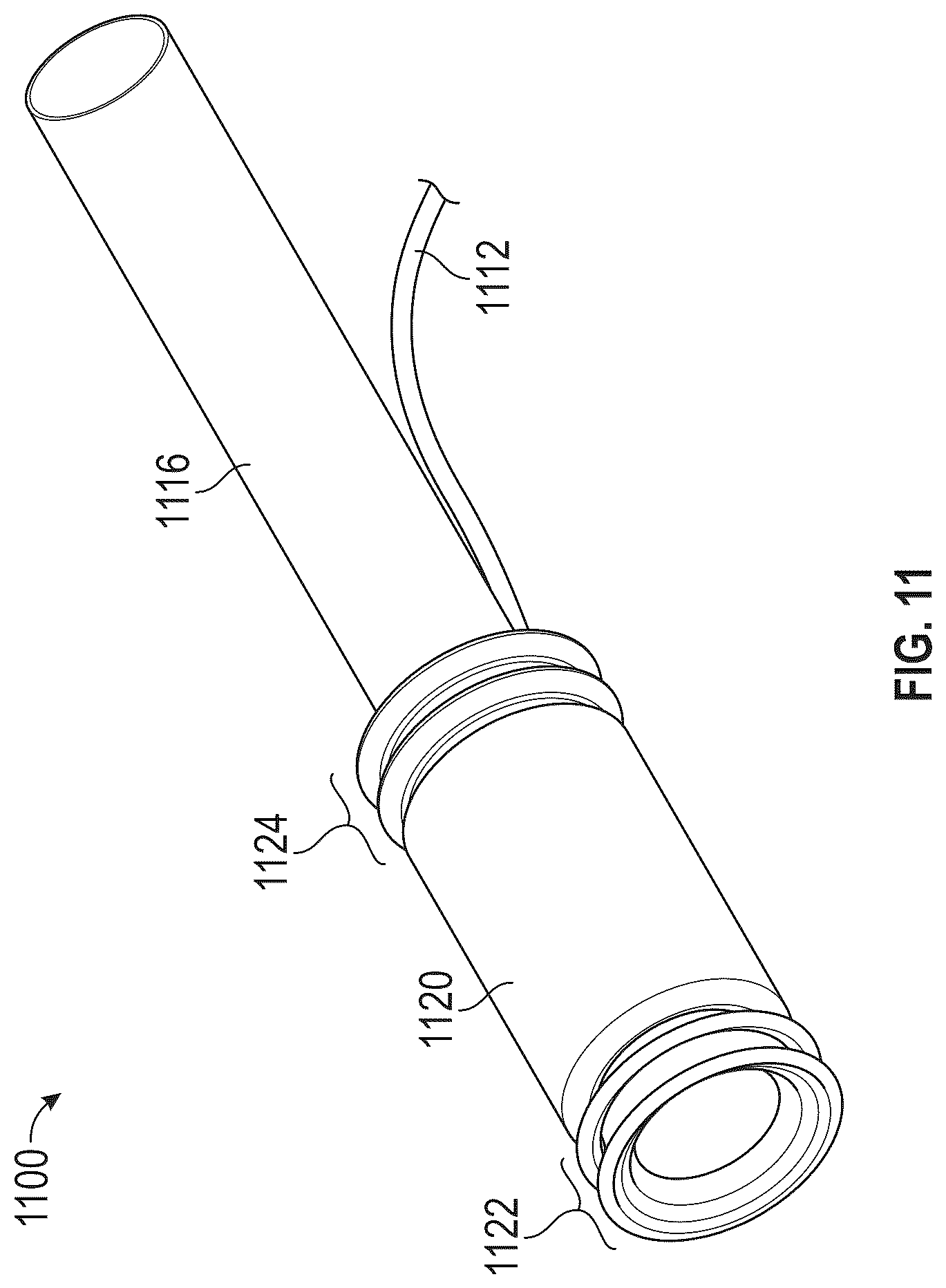 Patent US12508151 Figure 11 – Devices and methods for anchoring a sheath in a tissue cavity